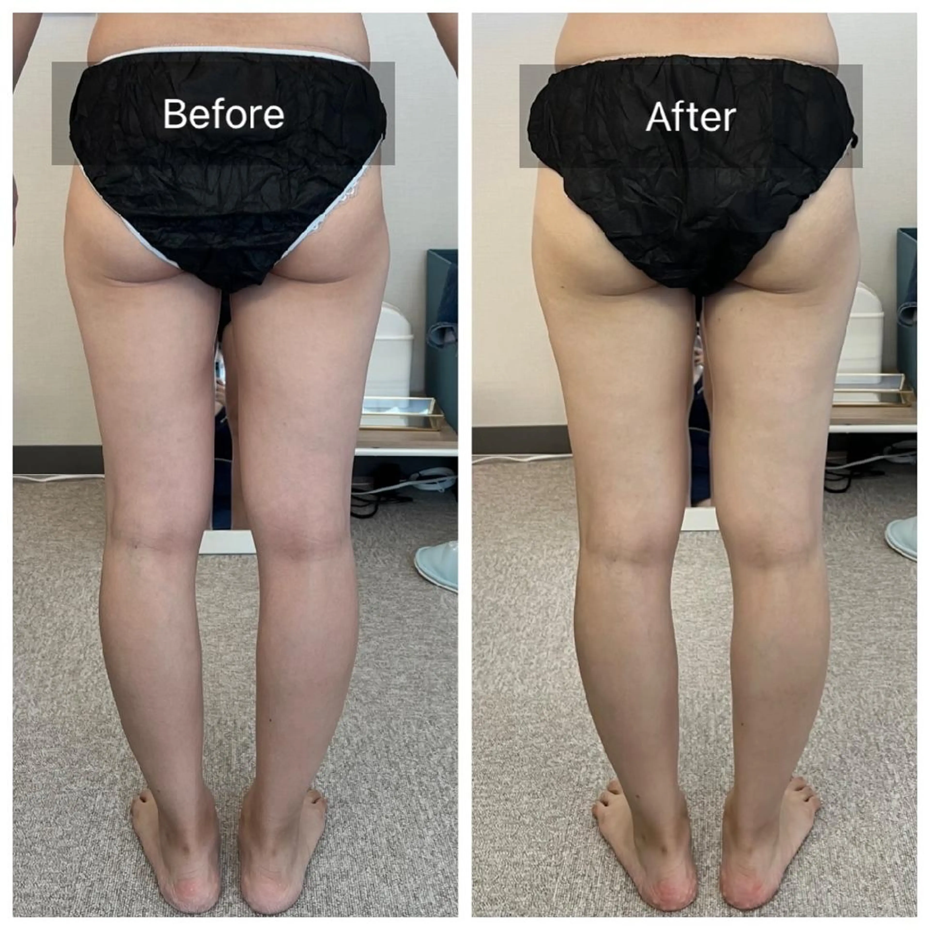 エステ プライベートサロンシャルム所属・プライベートサロン シャルムのその他イメージ