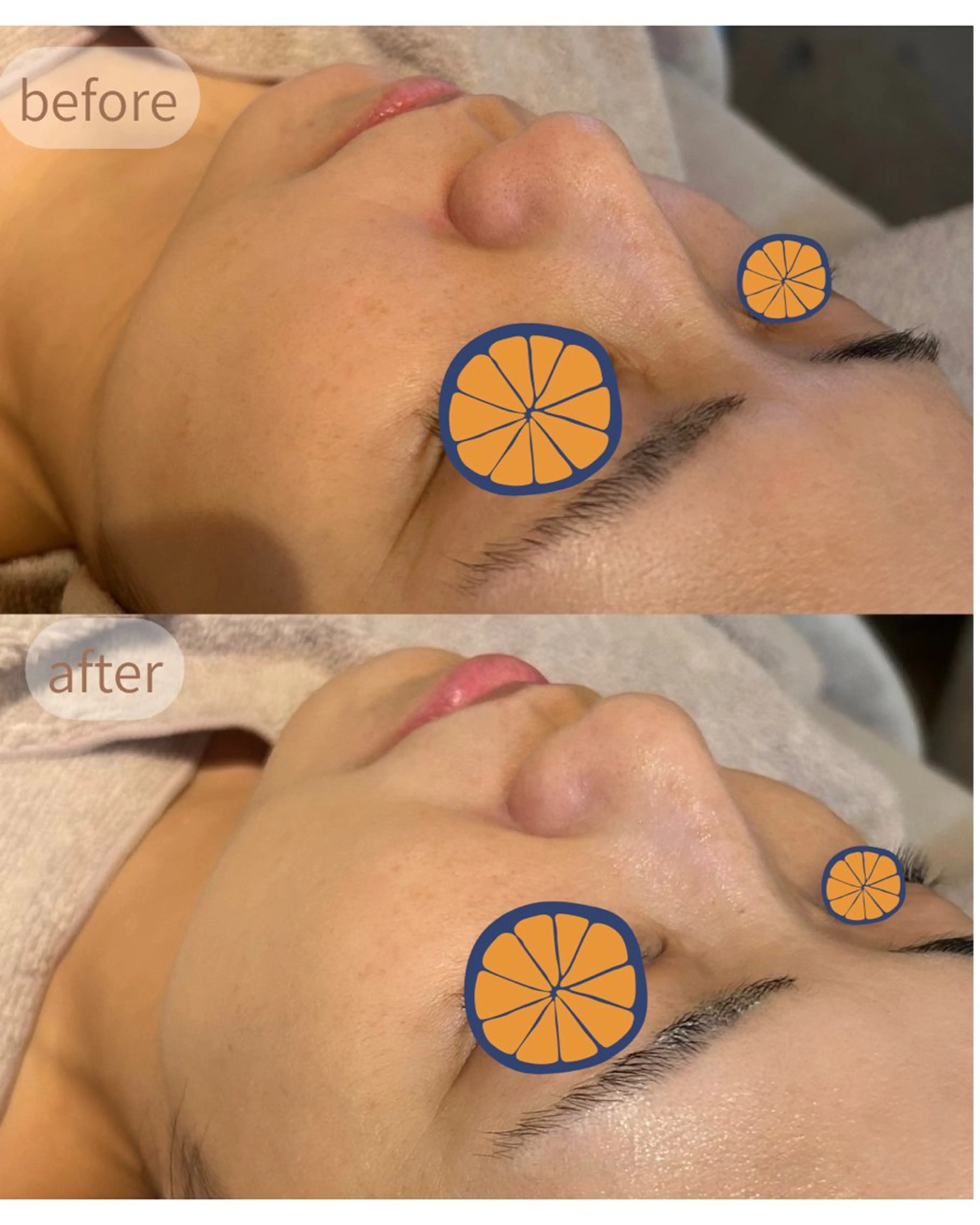 エステ MiEL total beauty salon所属・Rie ×MiELのエステ・リラクイメージ