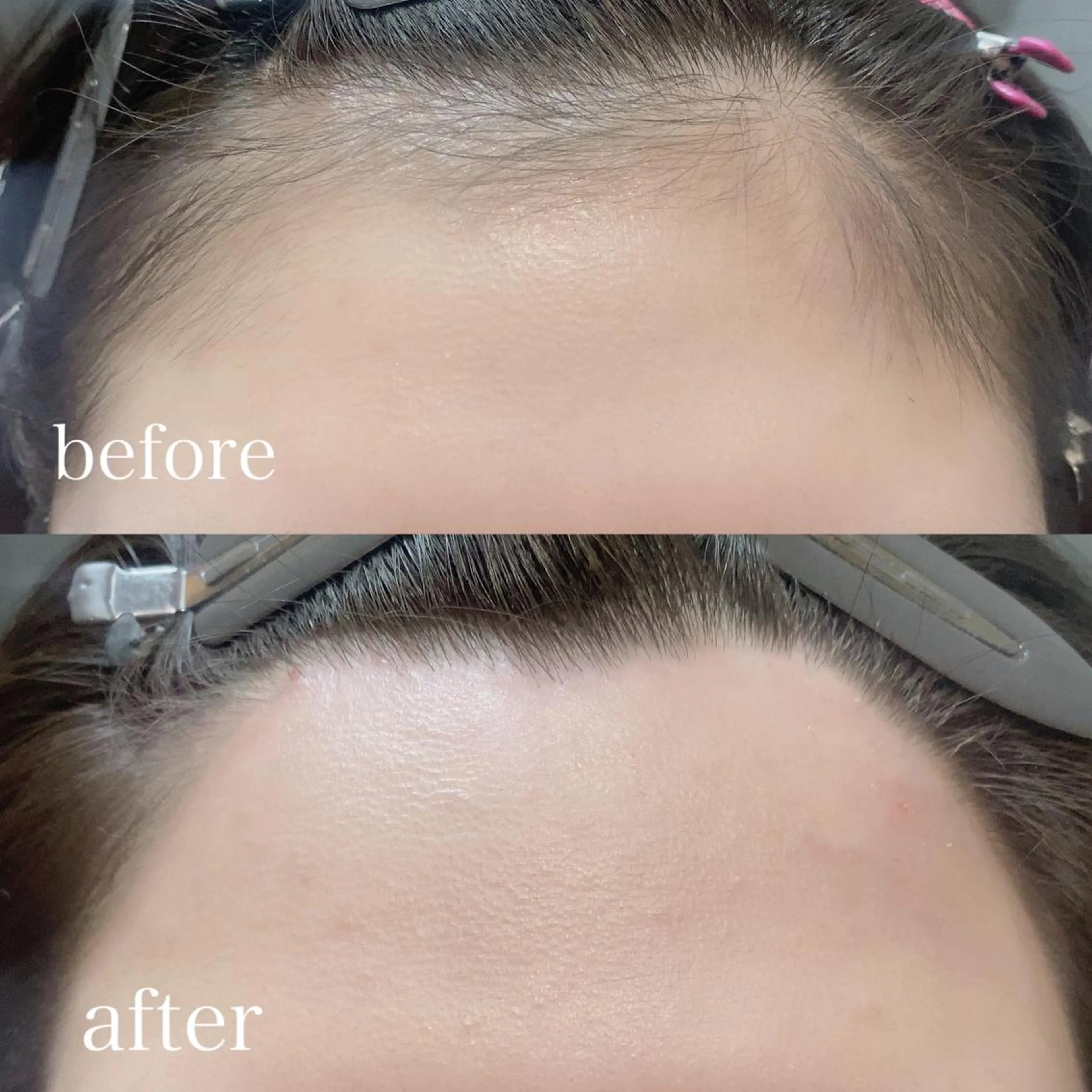 アイブロウ 眉毛ワックス脱毛 ワックス脱毛 眉カット その他(アイブロウ) apish aoyama所属・武 愛子の眉毛・アイブロウイメージ