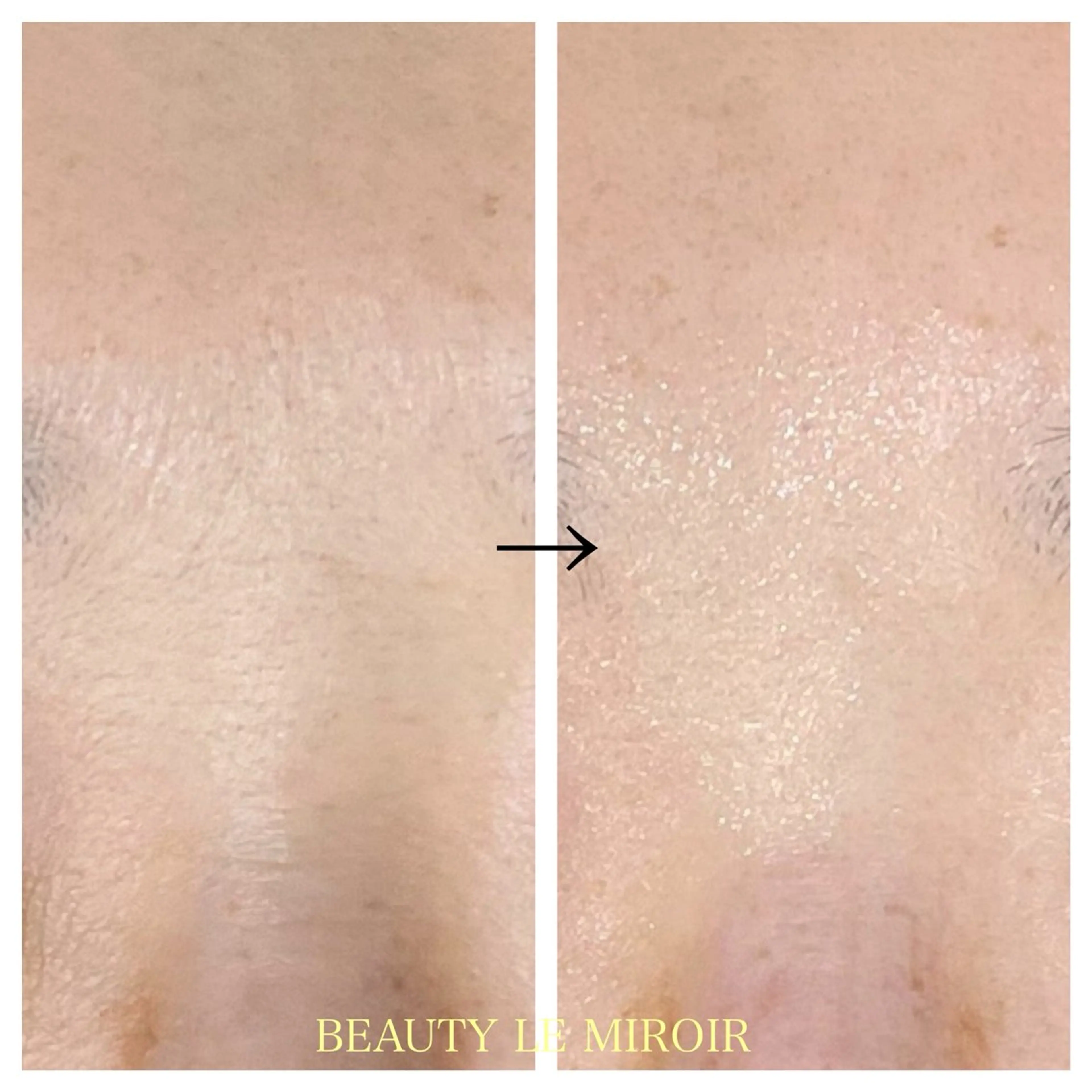 ビューティー ミロワールのエステ・リラクイメージ