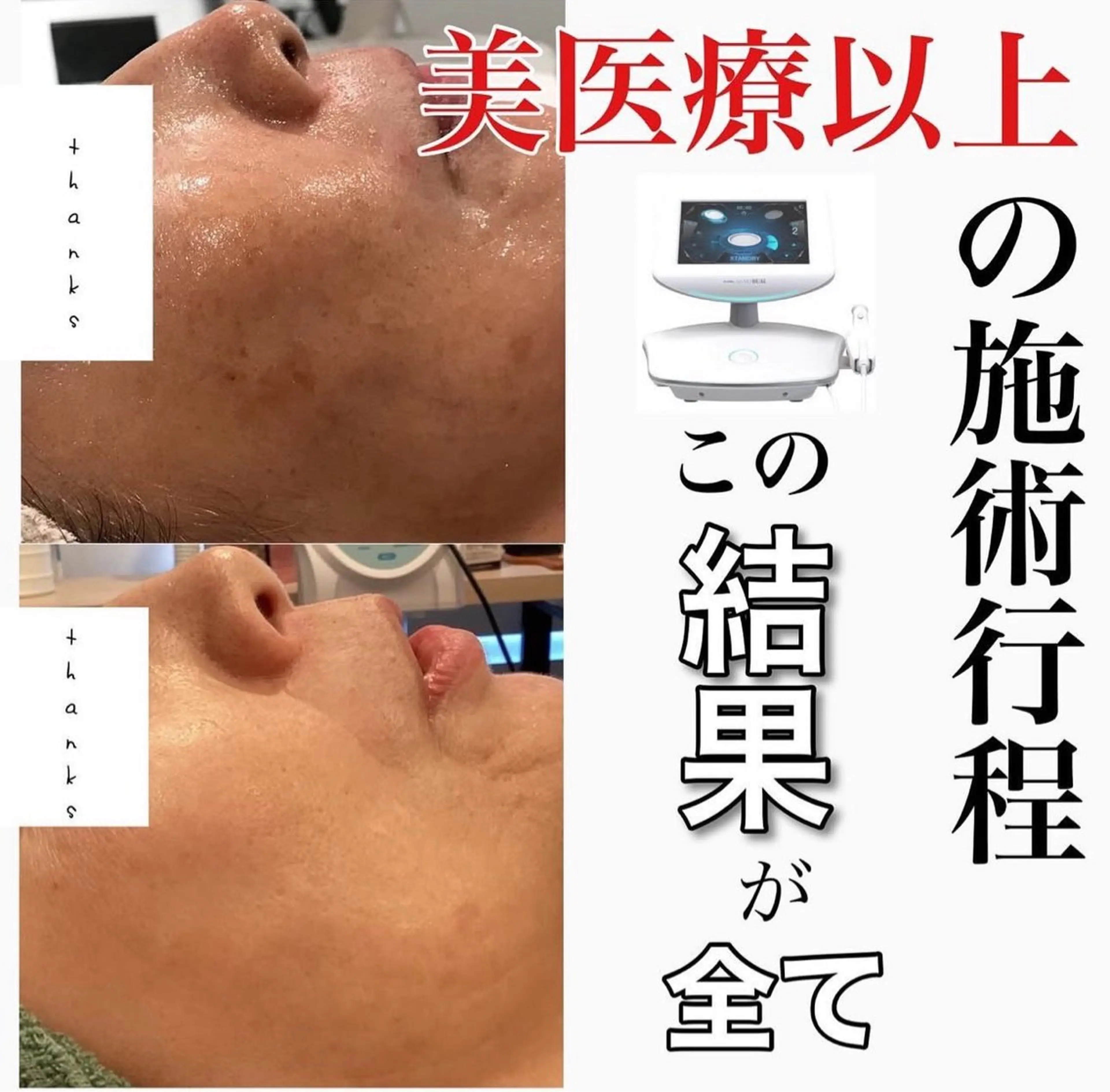 エステ Lumiere despoir所属・Lumiere despoirのエステ・リラクイメージ