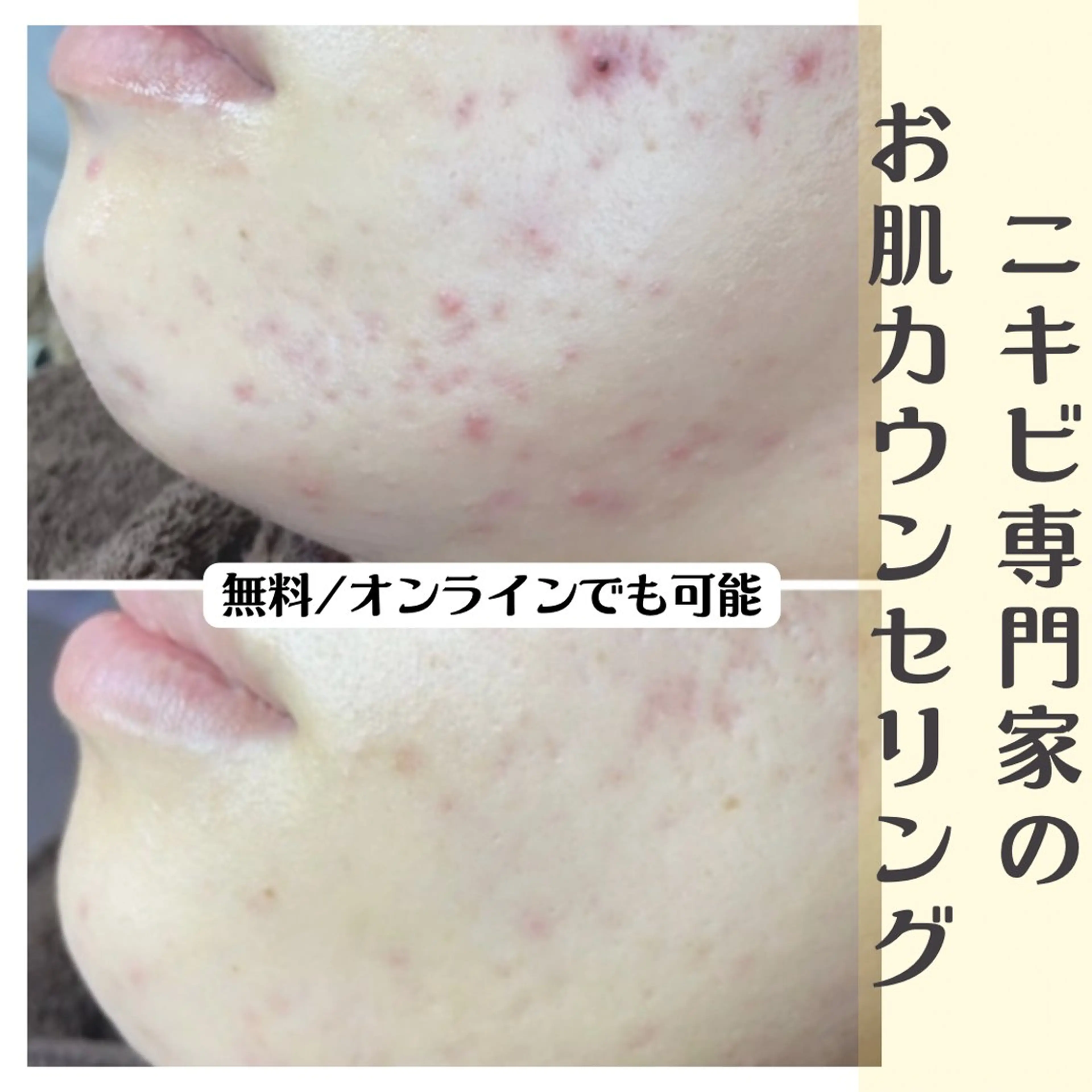 Muqu.所属・Muqu. 毛穴サロンのエステ・リラクイメージ