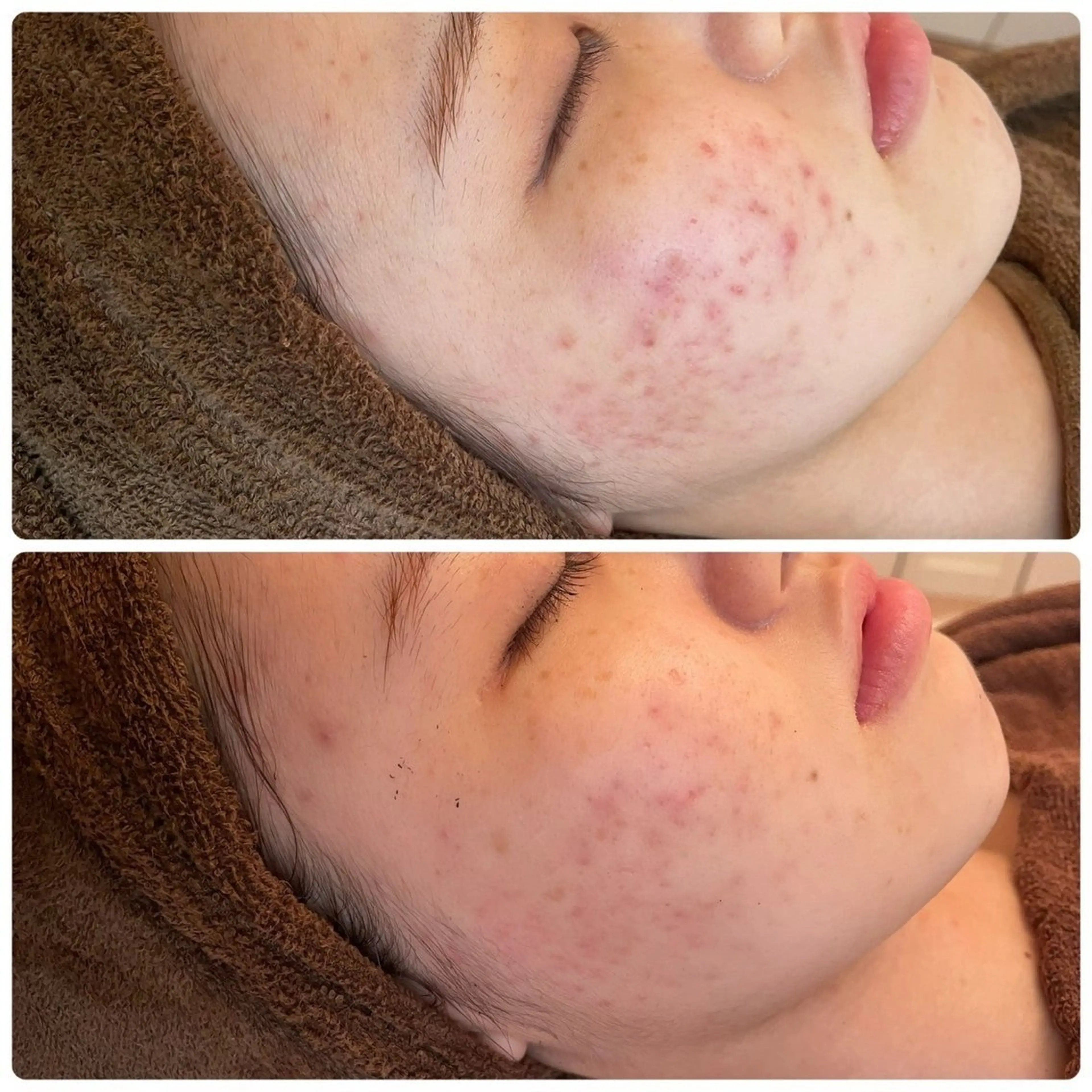 メンズ キッズ エステ ホワイトニングサロン プレジールのエステ・リラクイメージ