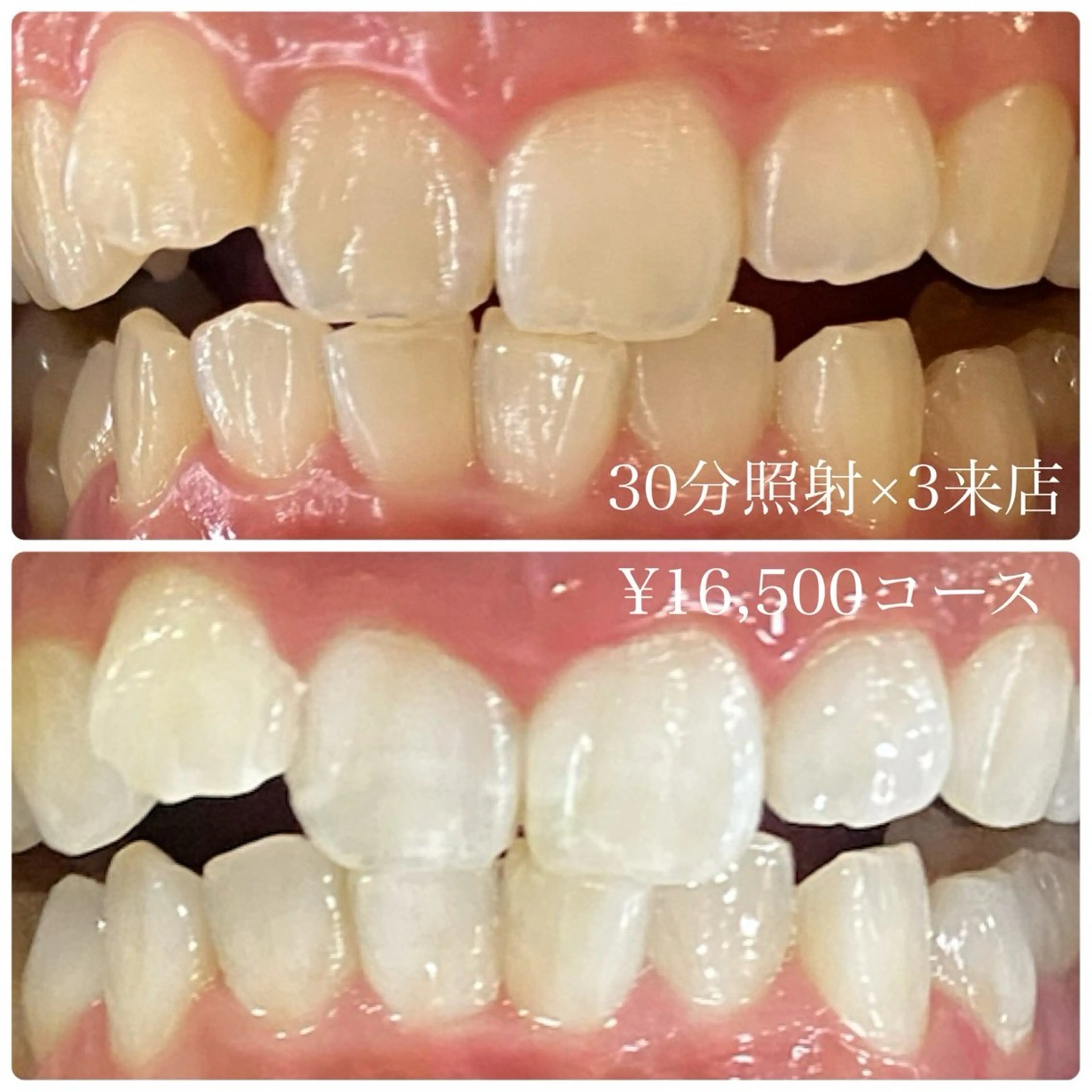 PLATINUM Beauty 横浜店所属・ホワイトニングルーム 横浜店のその他イメージ