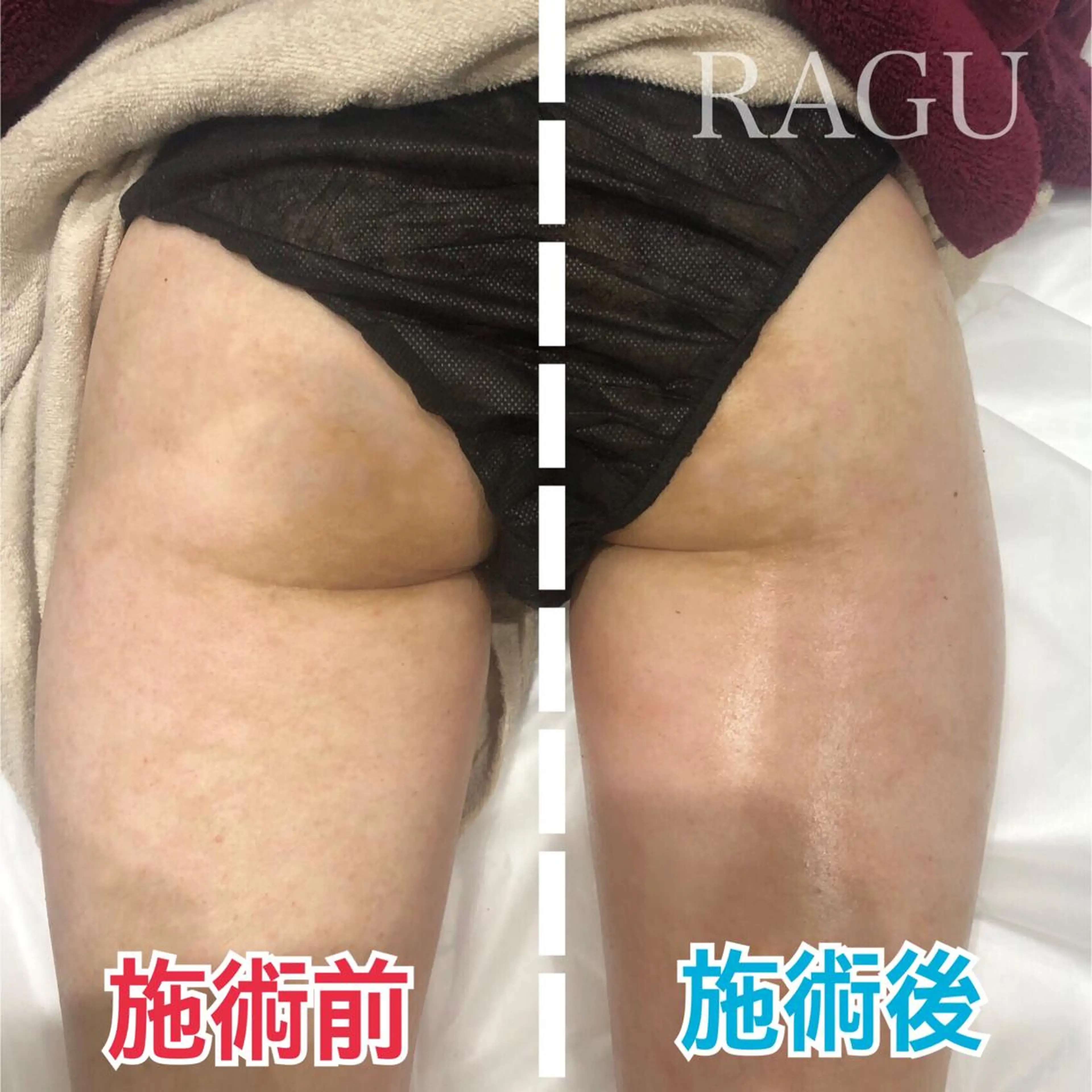 エステ RAGU BEAUTY所属・原口 彩子のエステ・リラクイメージ