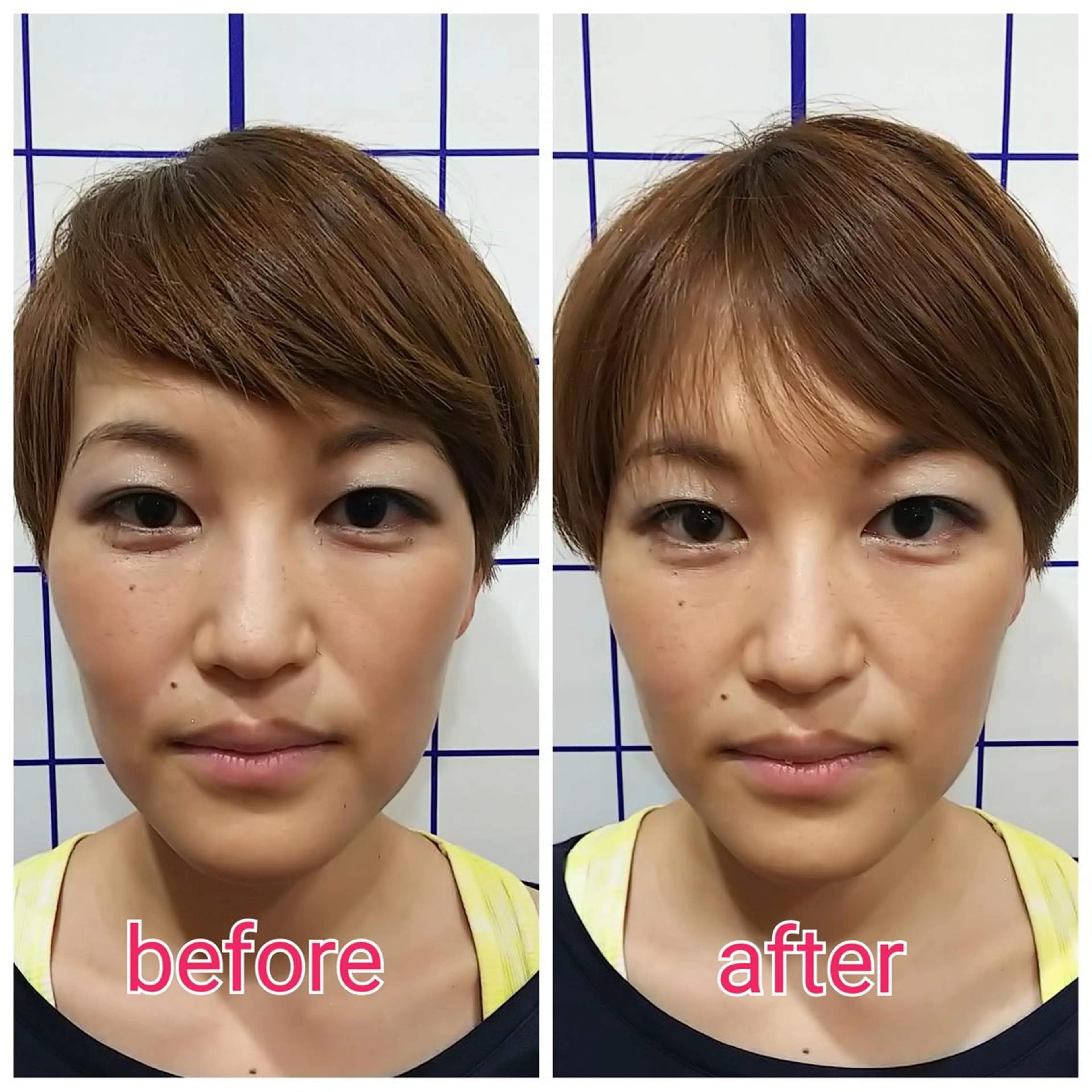 お顔のむくみたるみ 専門☆美容鍼小顔矯正のエステ・リラクイメージ