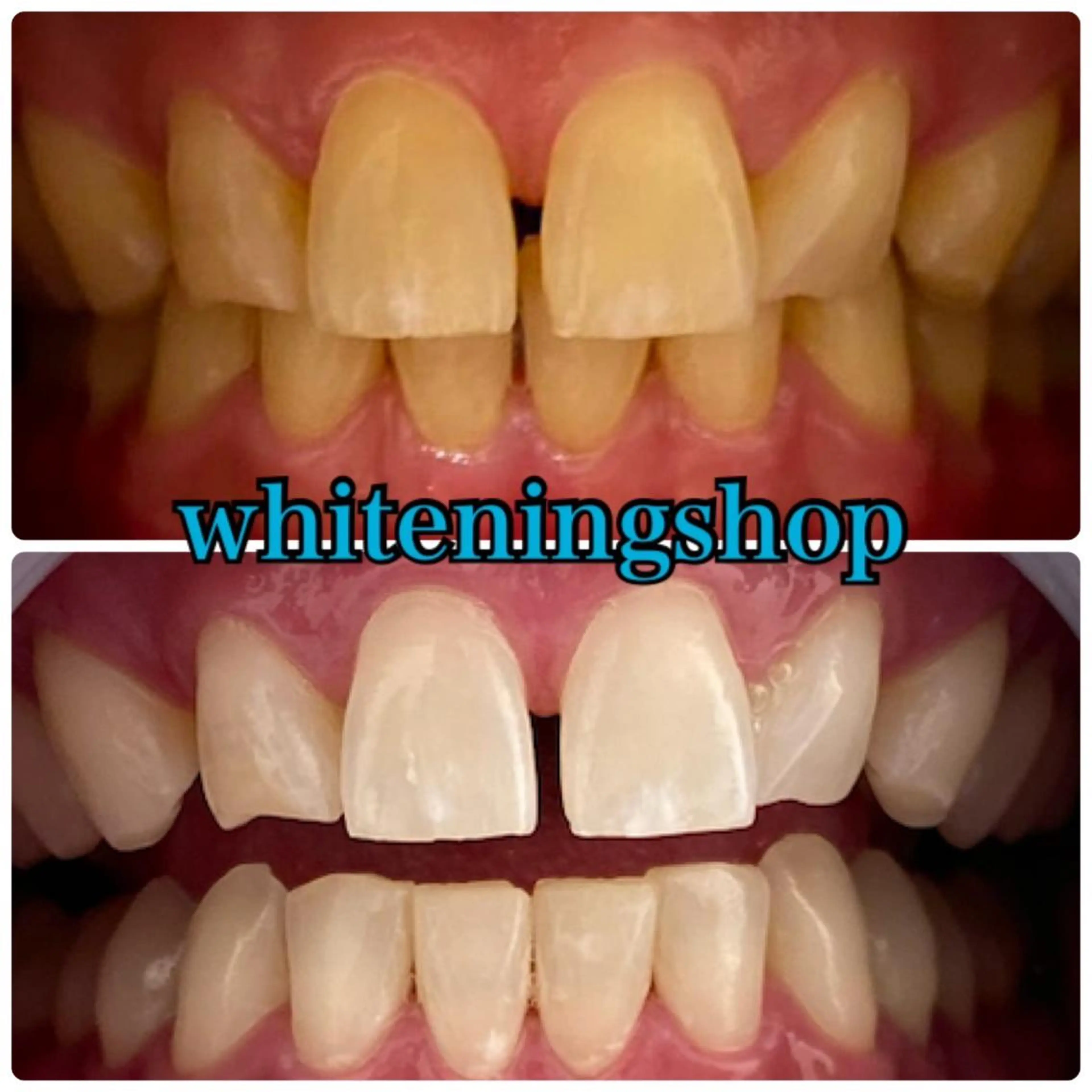 ホワイトニング ショップ吉祥寺店のエステ・リラクイメージ