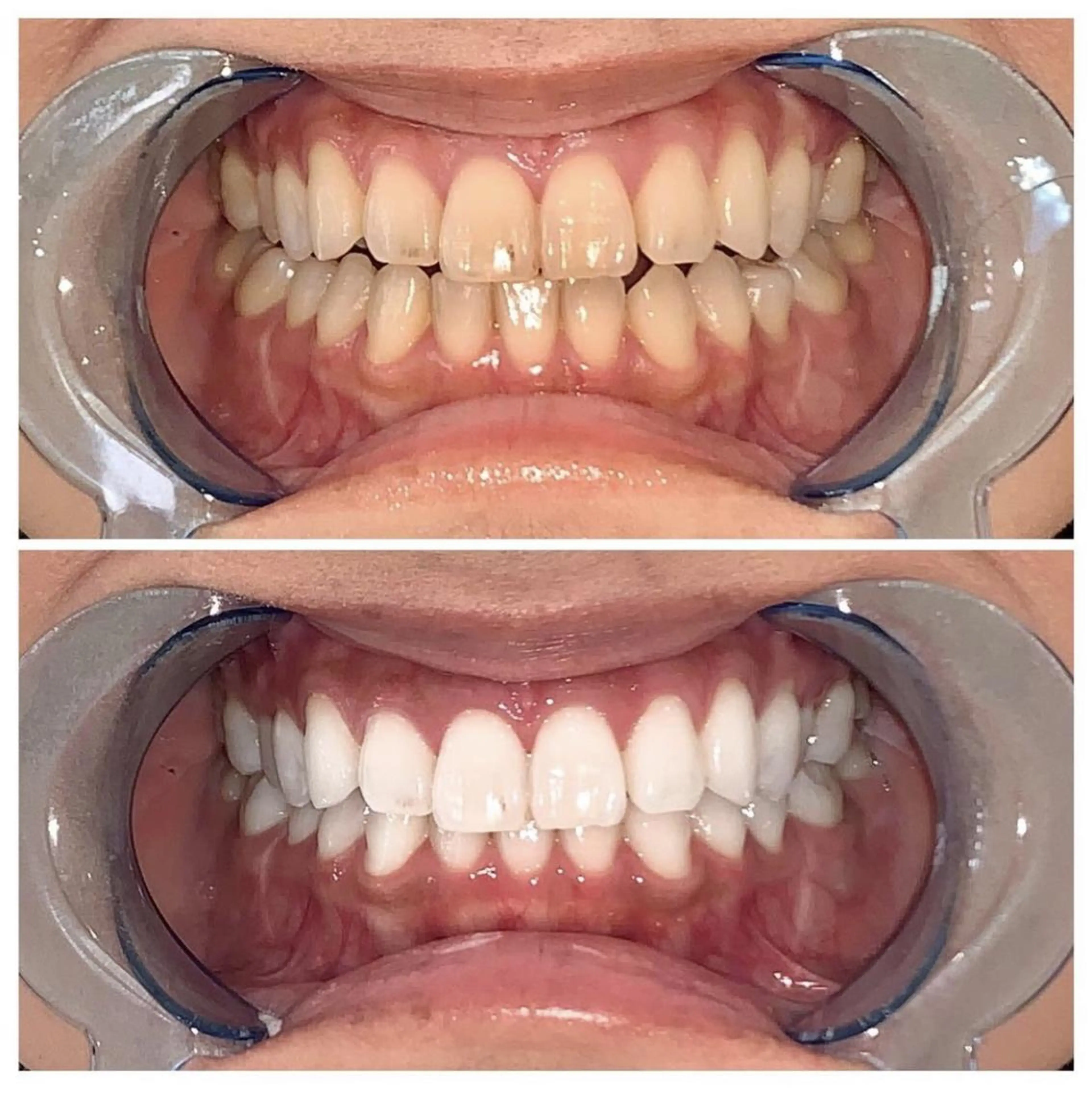 カラー メンズ マツエク・マツパ ネイル ヘアアレンジ パーマ キッズ アイブロウ ロング ホワイト その他 ライトビューティー 銀座本店のエステ・リラクイメージ