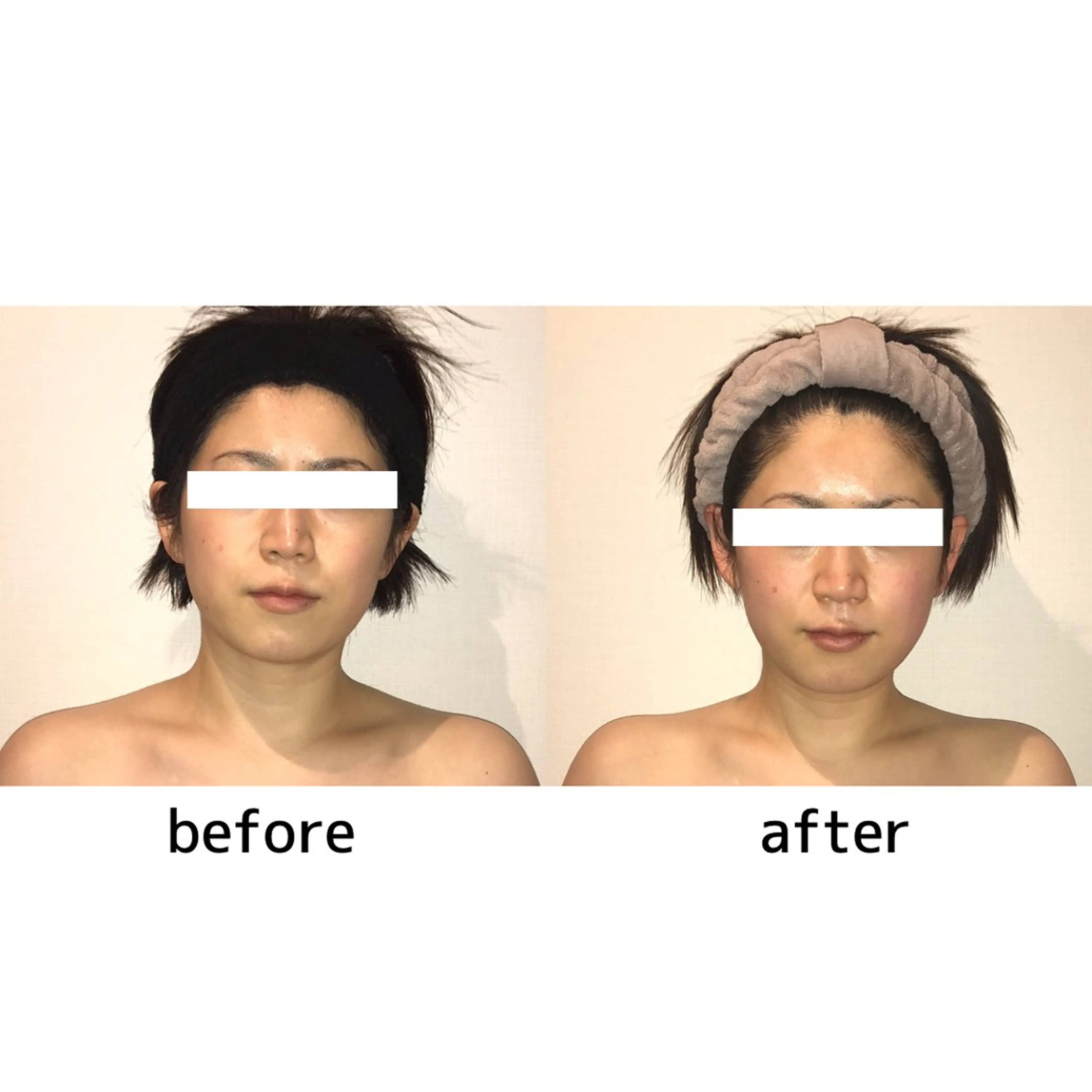 【こりとりコルギ】身体から徹底ほぐし❣️結果重視の本格コルギ✦速攻スッキリ小顔💆♀️✨<<都度払い>>の写真