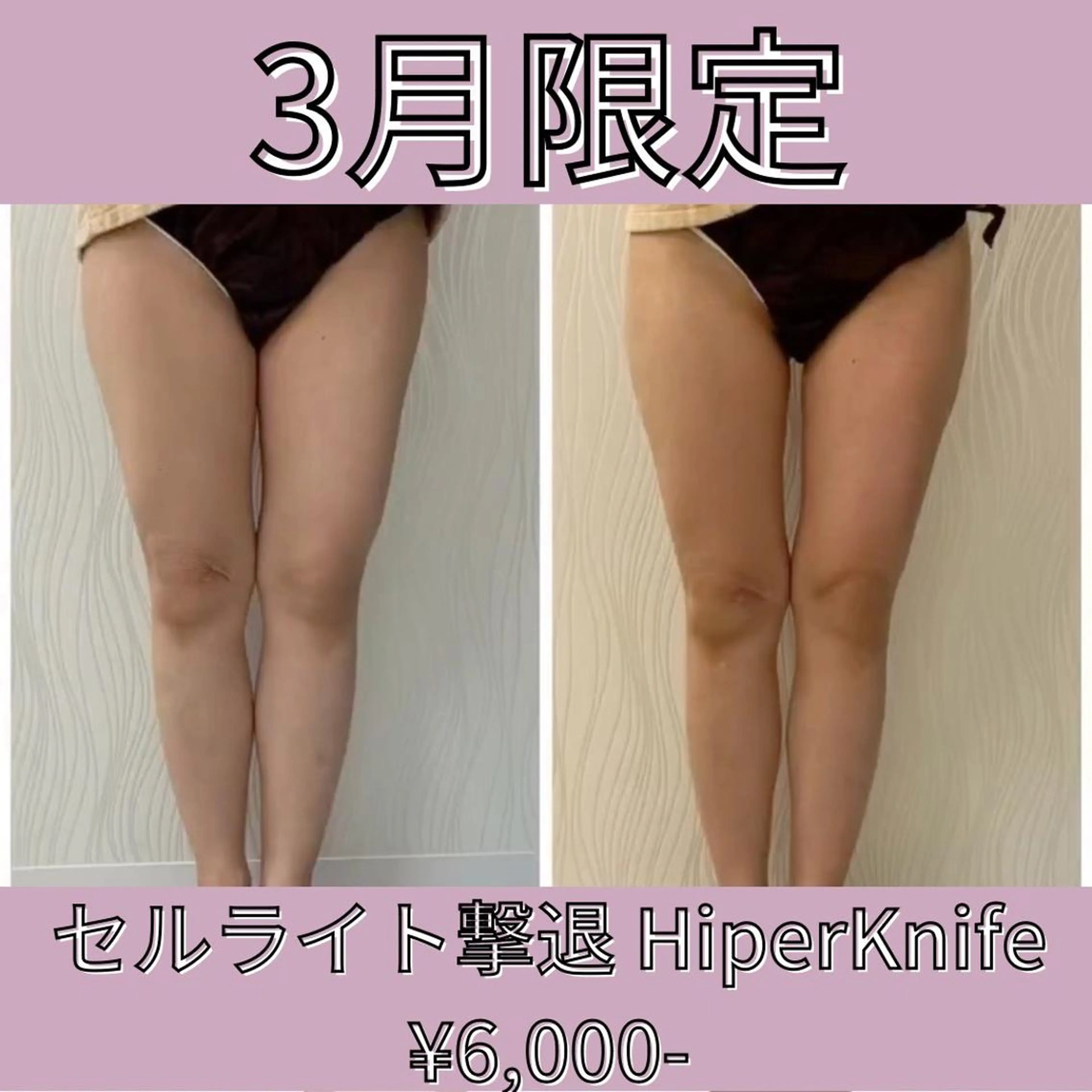 エステ 次世代痩身 人生最後のダイエットのエステ・リラクイメージ