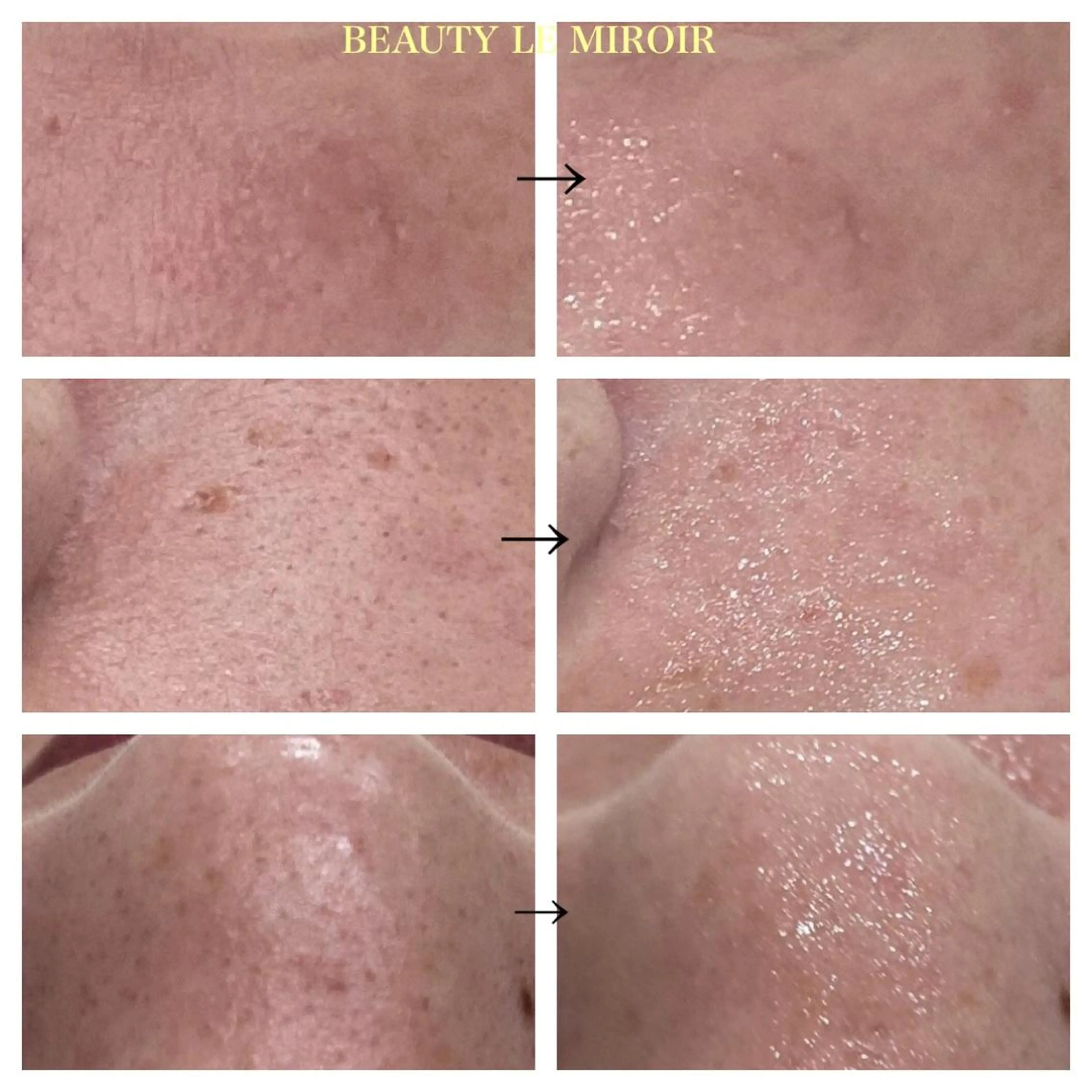 エステ ビューティー ミロワールのエステ・リラクイメージ