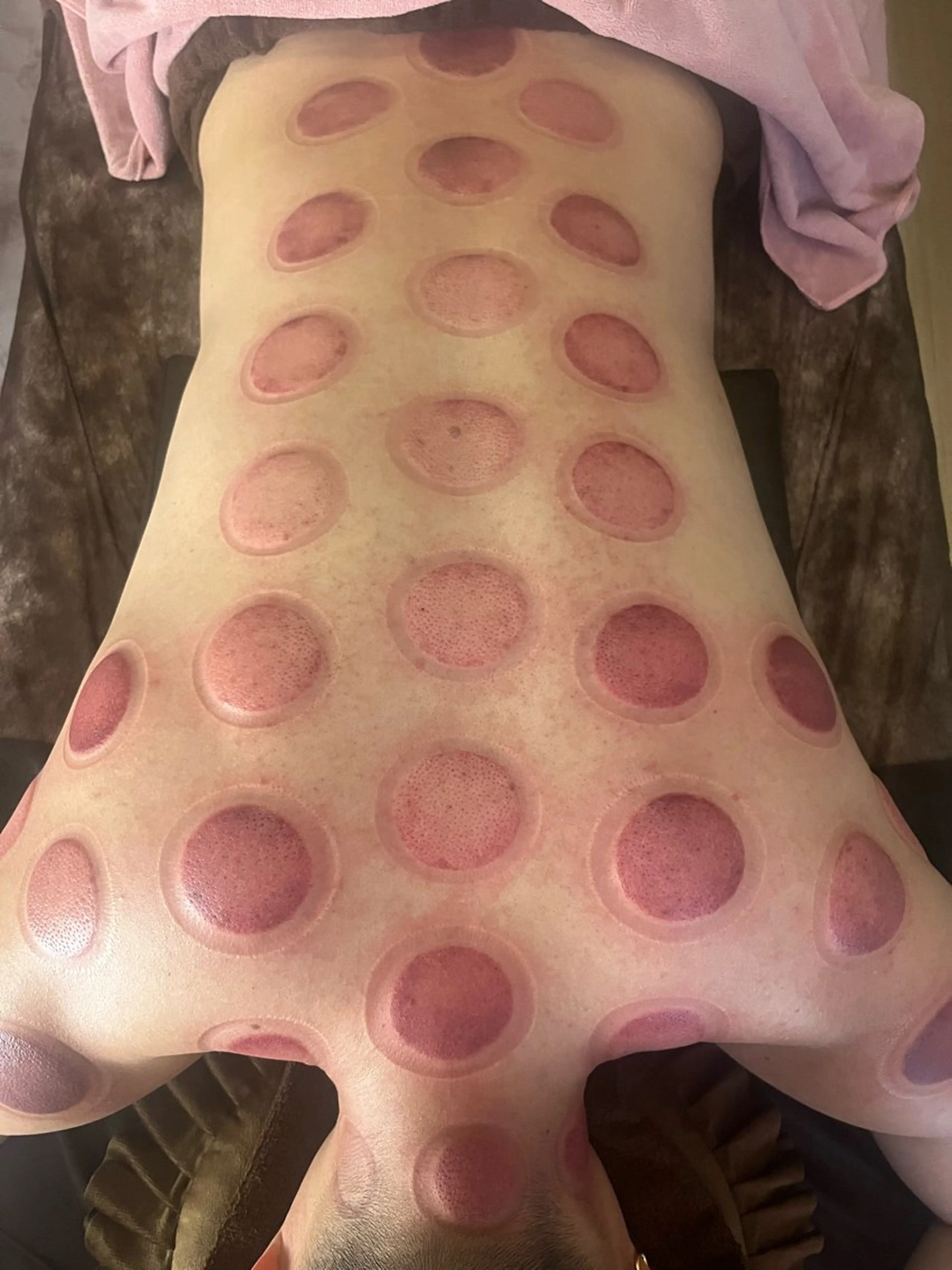 アロマ･美容鍼･カッ ピング「麗」鍼灸院のエステ・リラクイメージ