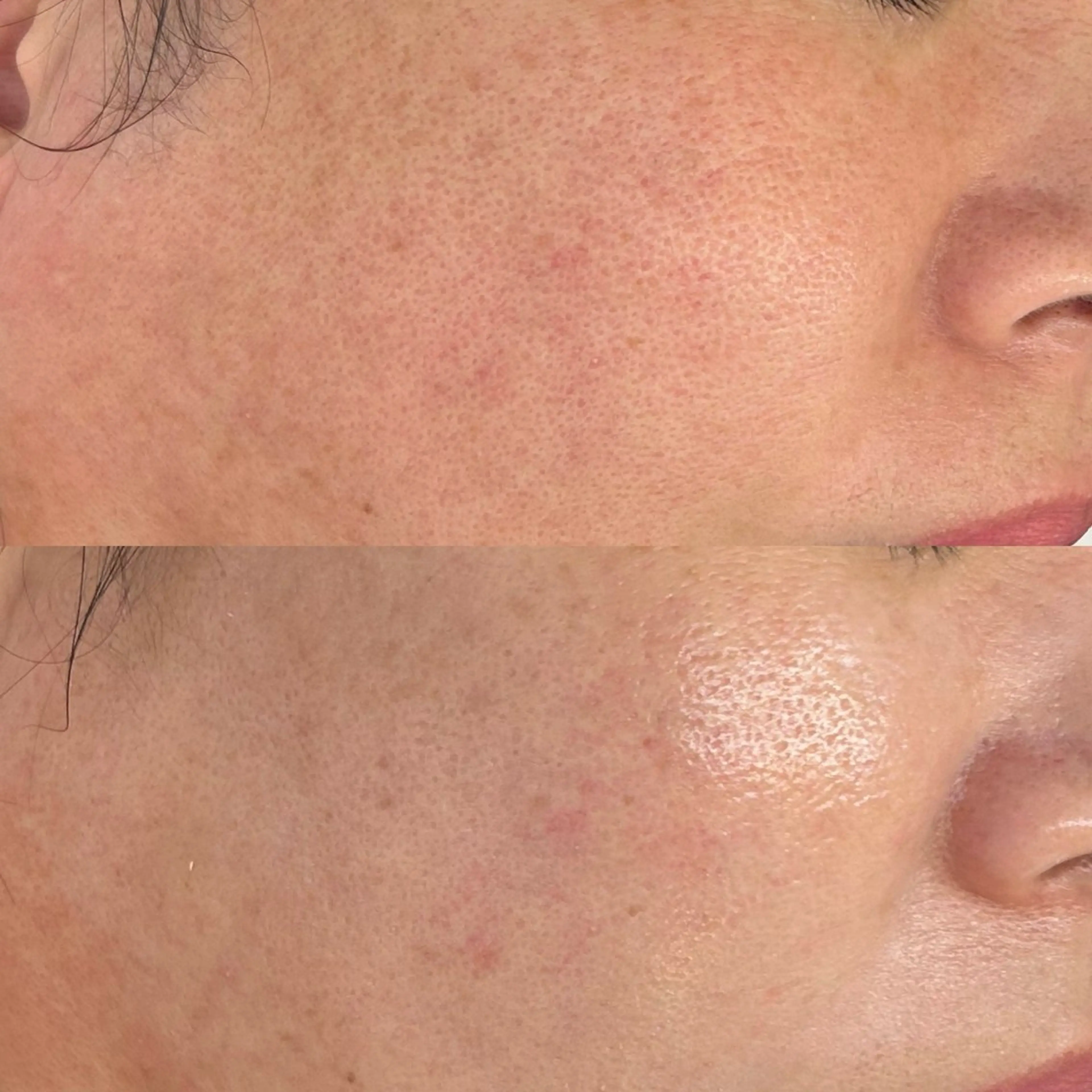 エステ 韓国🇰🇷価格 サロン_Nbibiのエステ・リラクイメージ