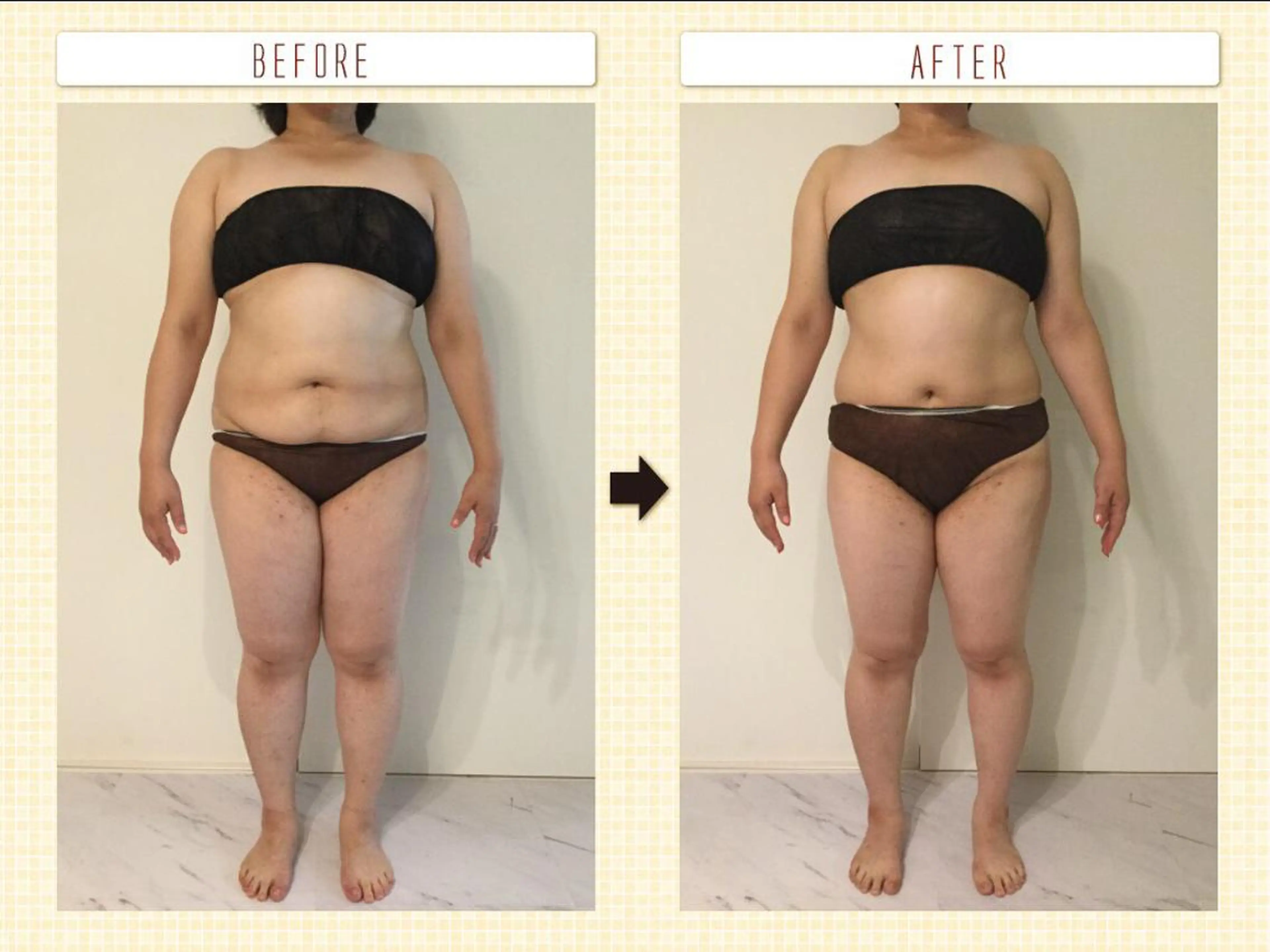 マツエク・マツパ 松居 舞のその他イメージ