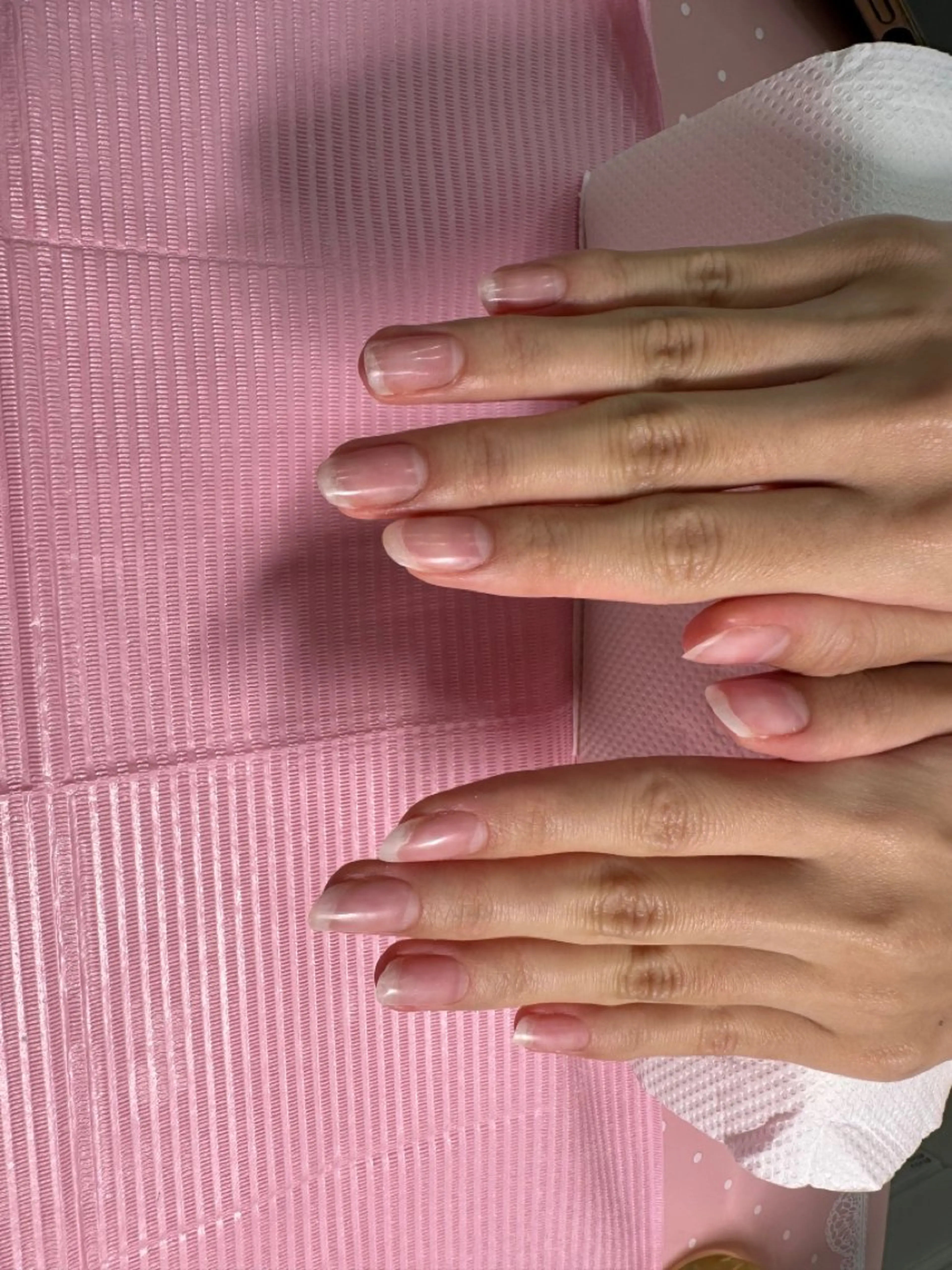 スカルプorチップオフのみ(ケア込み)の写真