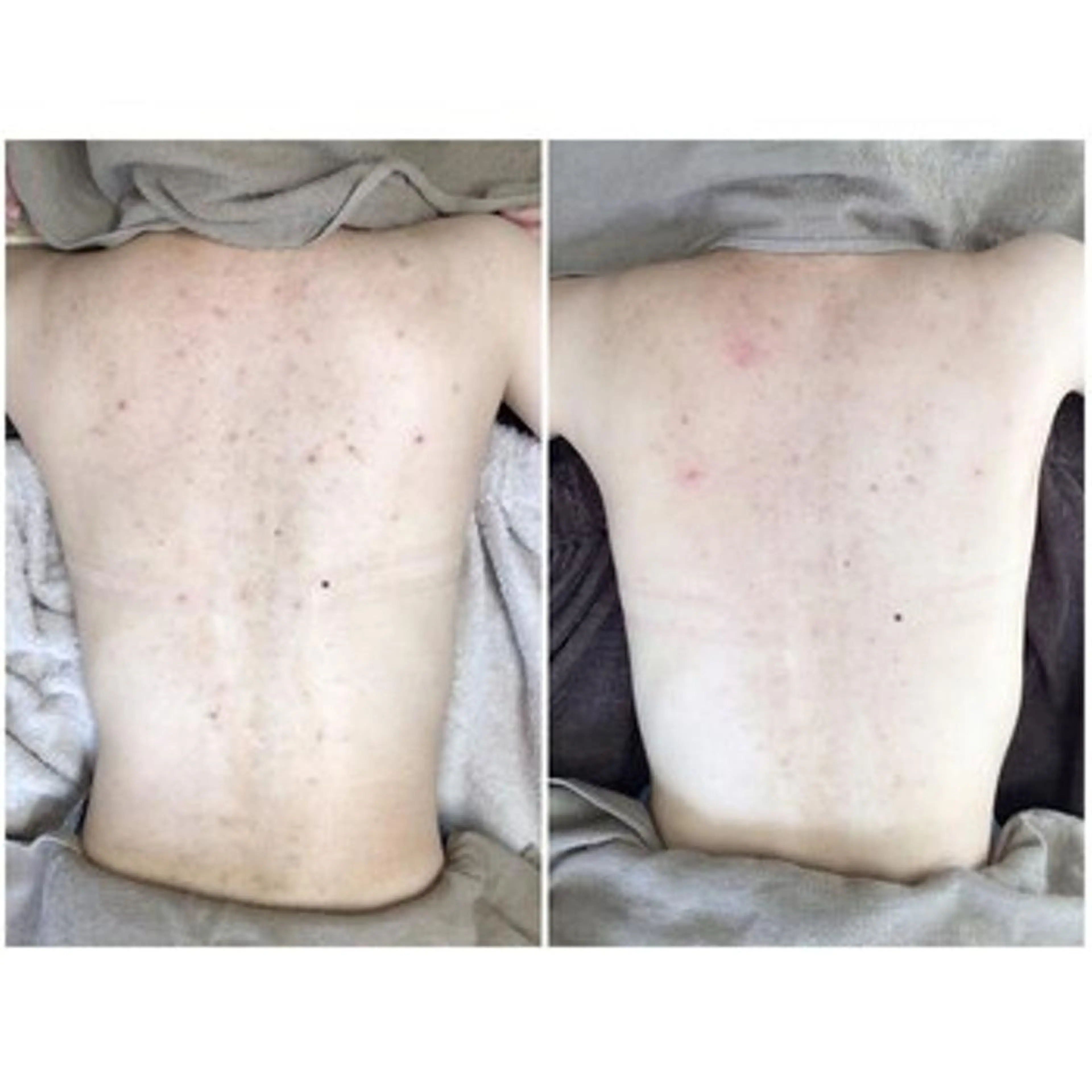 毛穴/毛穴洗浄専門 エミルカ船橋のエステ・リラクイメージ