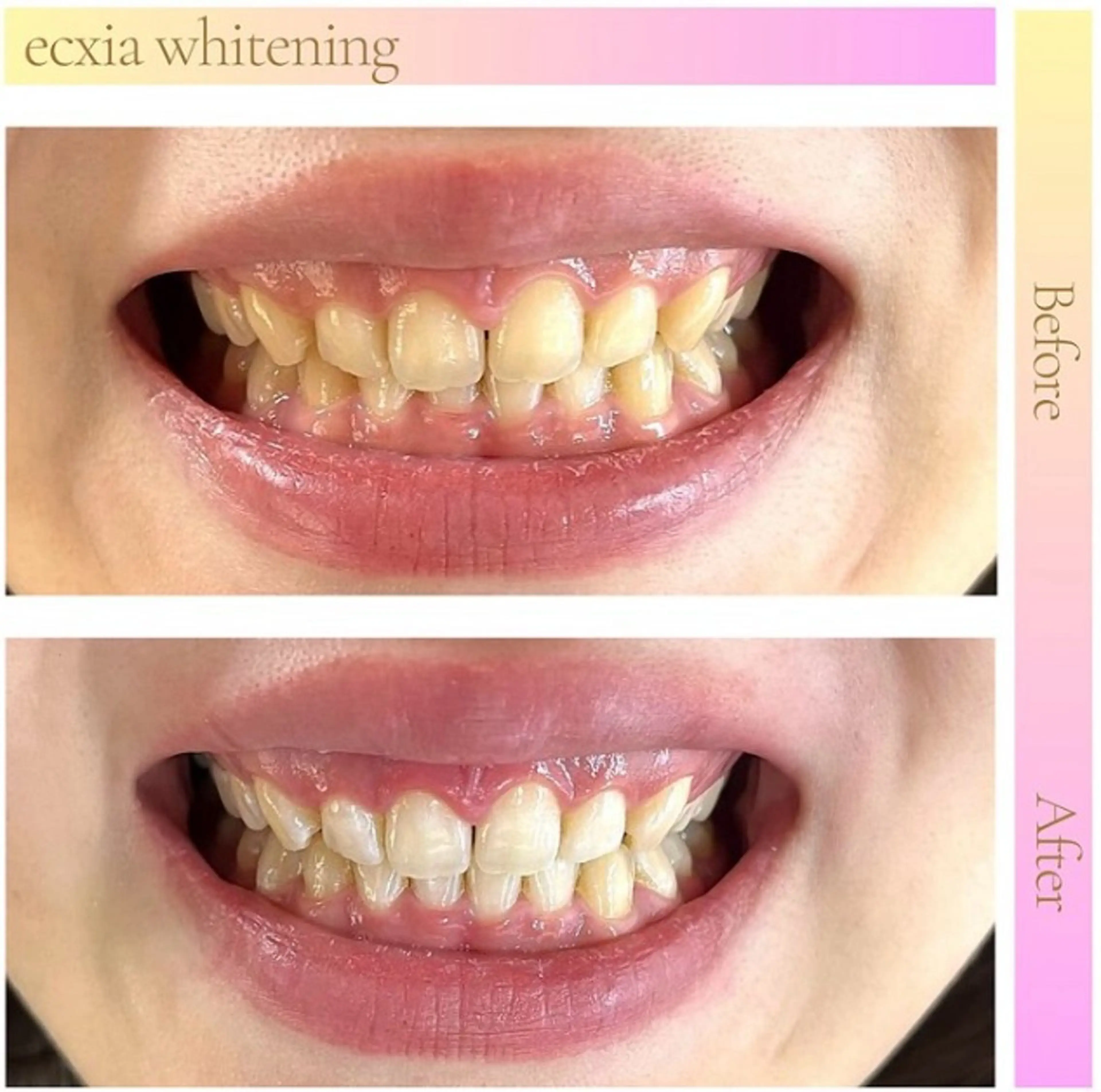 エクシアホワイト 伊勢崎店のその他イメージ