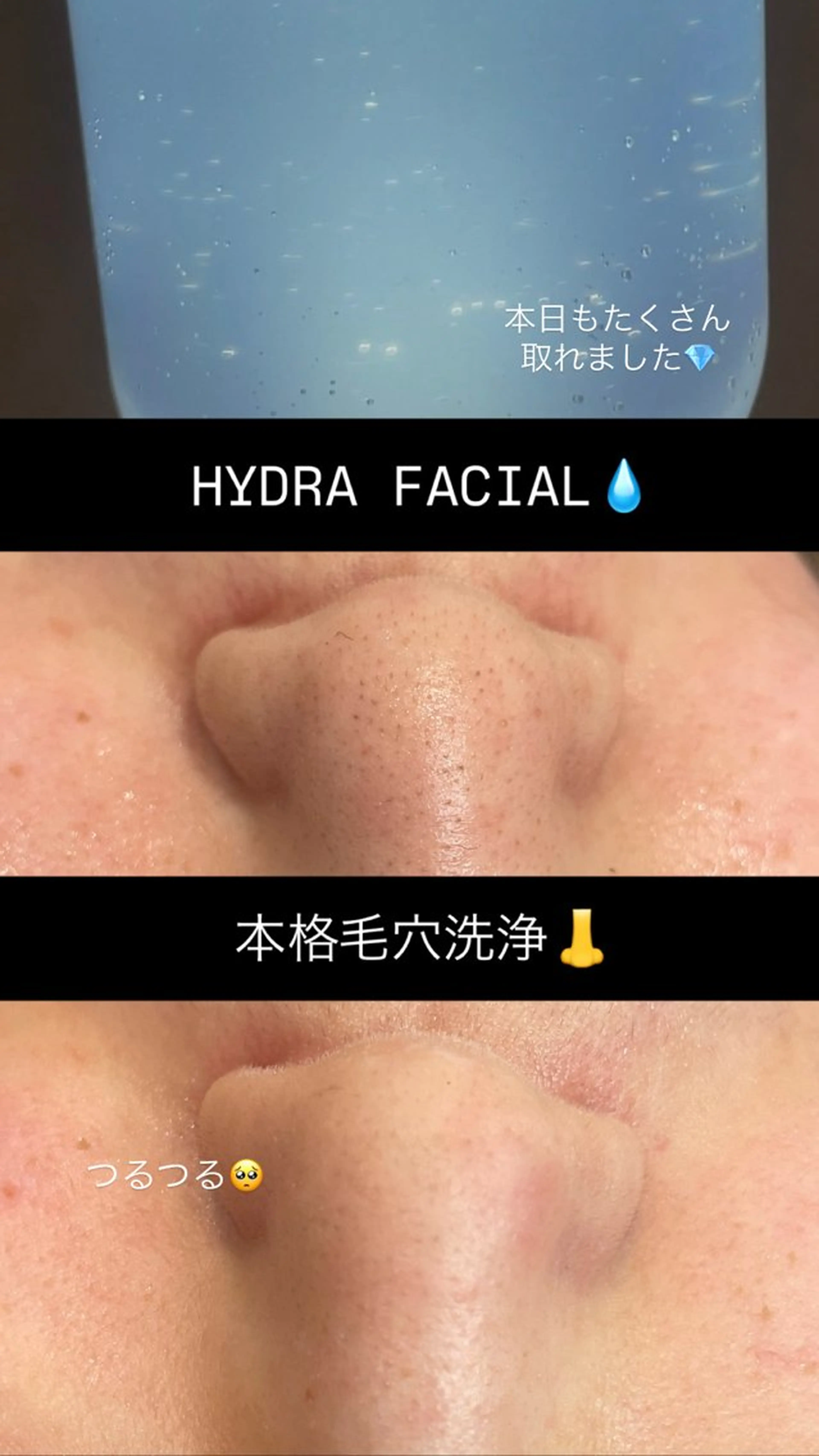 エステ トータルビューティーサロンFirstclass所属・Firstclass Erikaのエステ・リラクイメージ