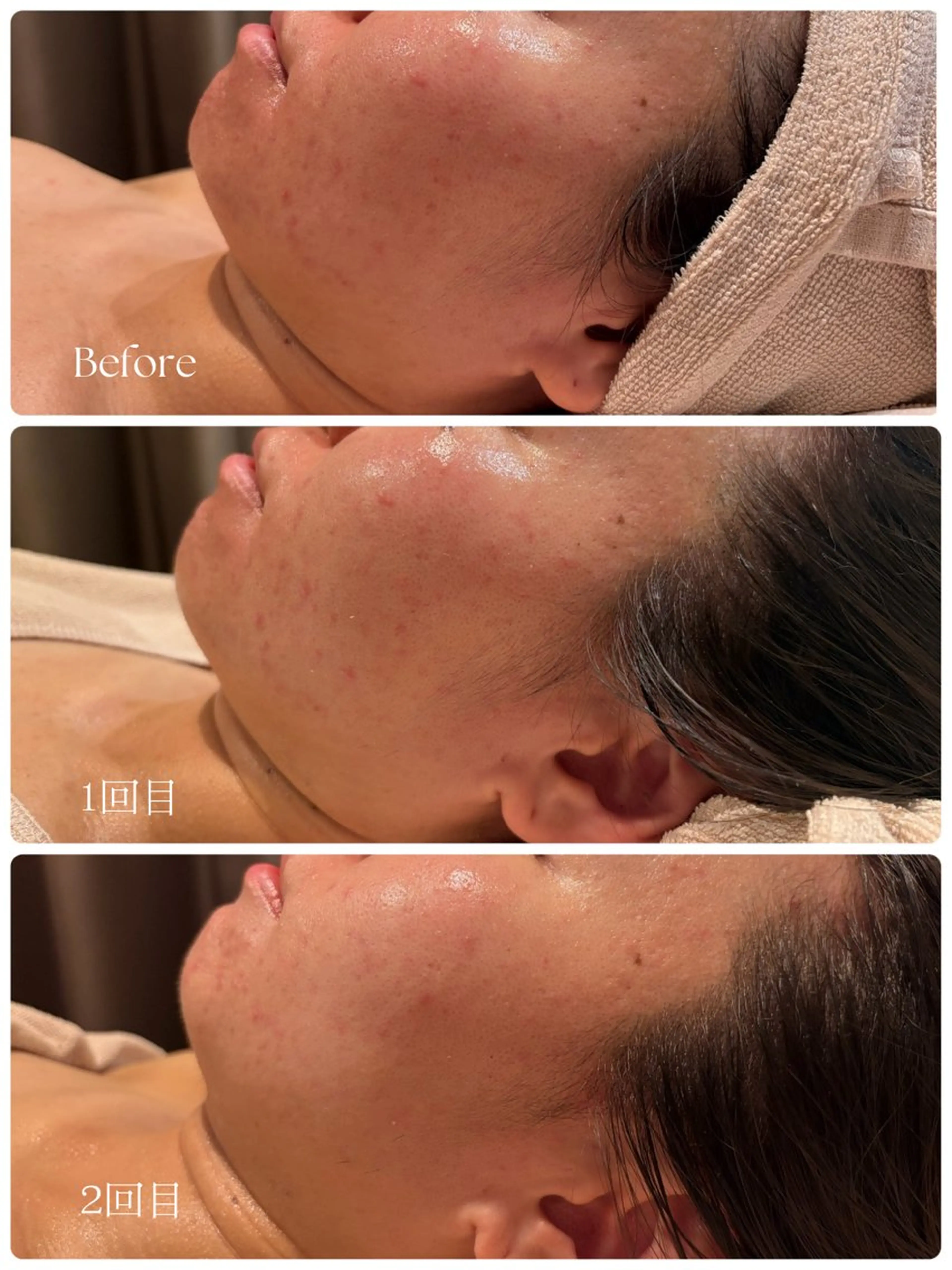 エステ /ulu  soin所属・太田 玲奈のエステ・リラクイメージ