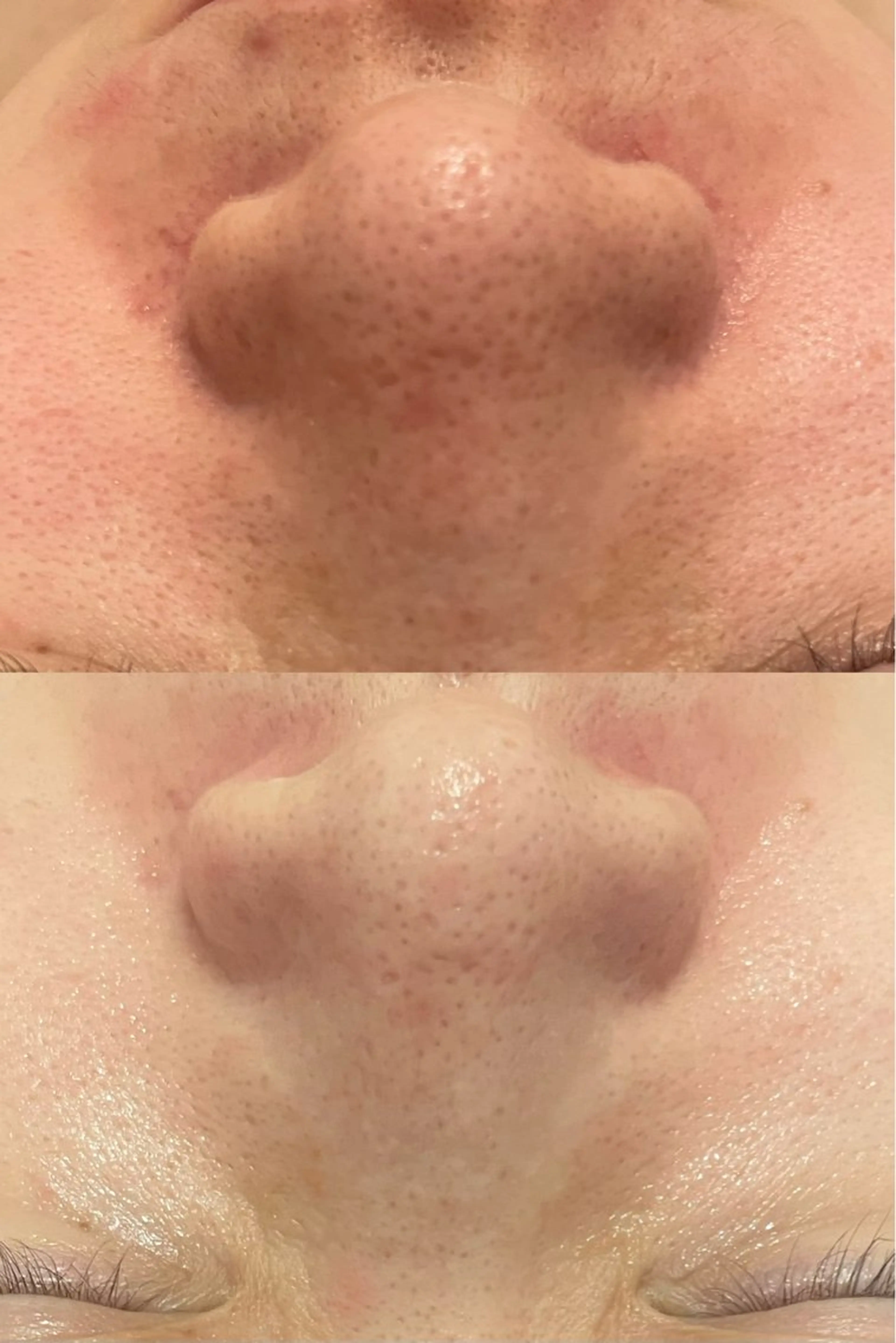 エステ リラク 西区九条エステ MITUREIサロンのエステ・リラクイメージ