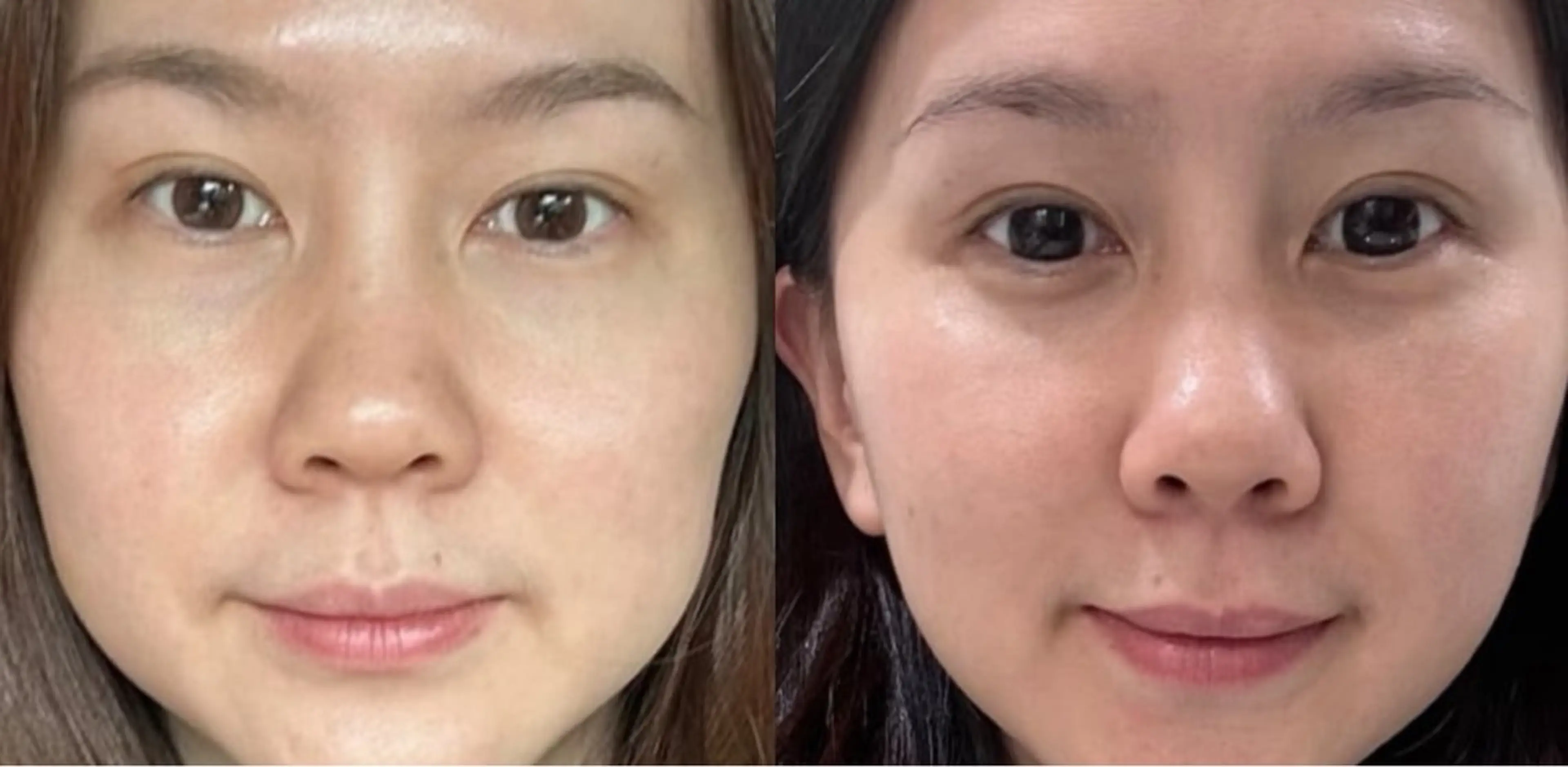 マツエク・マツパ エステ aliaハイフ&水光ジェットサロン所属・aliaハーブ水光店 エステティシャン募集のエステ・リラクイメージ