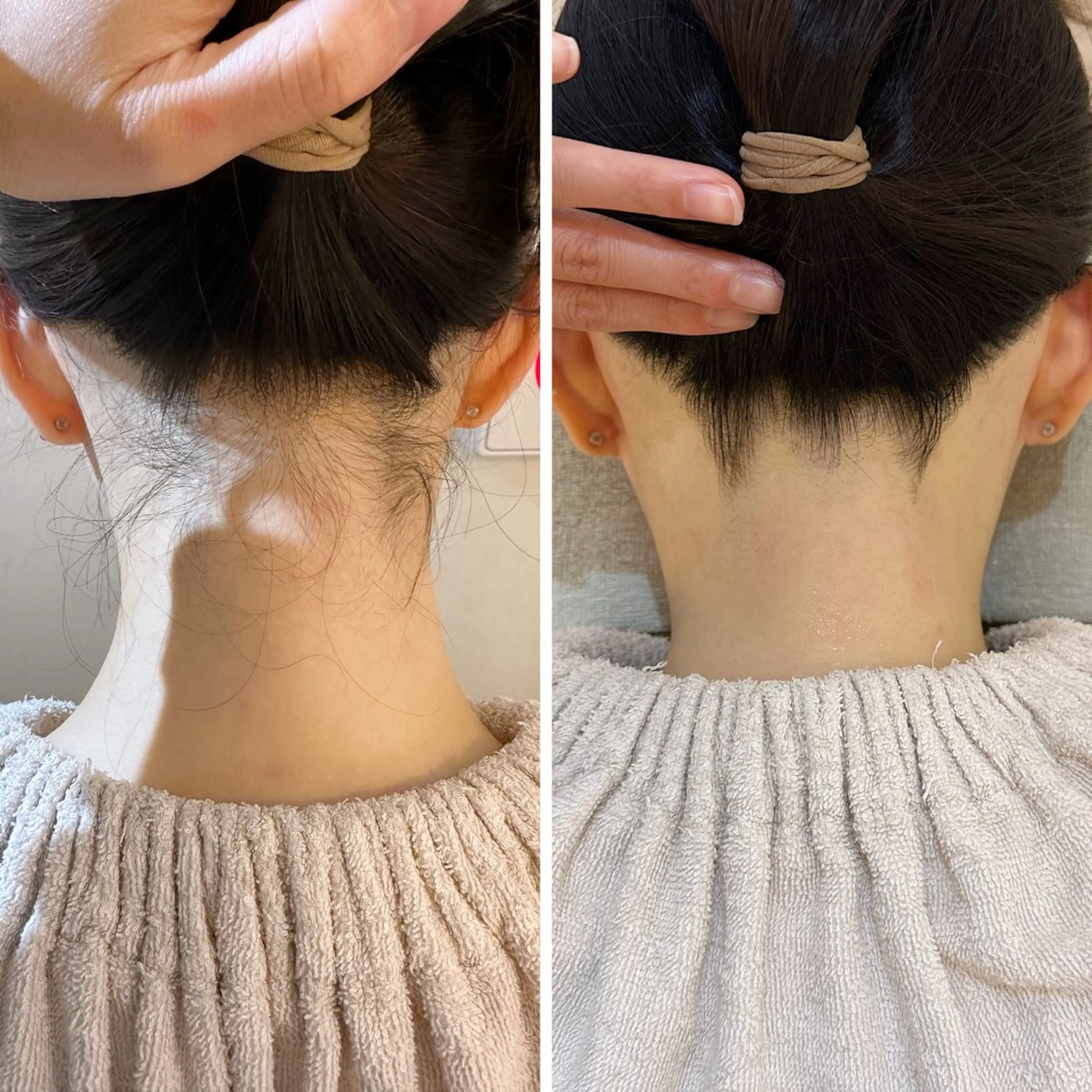 脱毛 うなじ脱毛/美肌脱毛 LABELのエステ・リラクイメージ