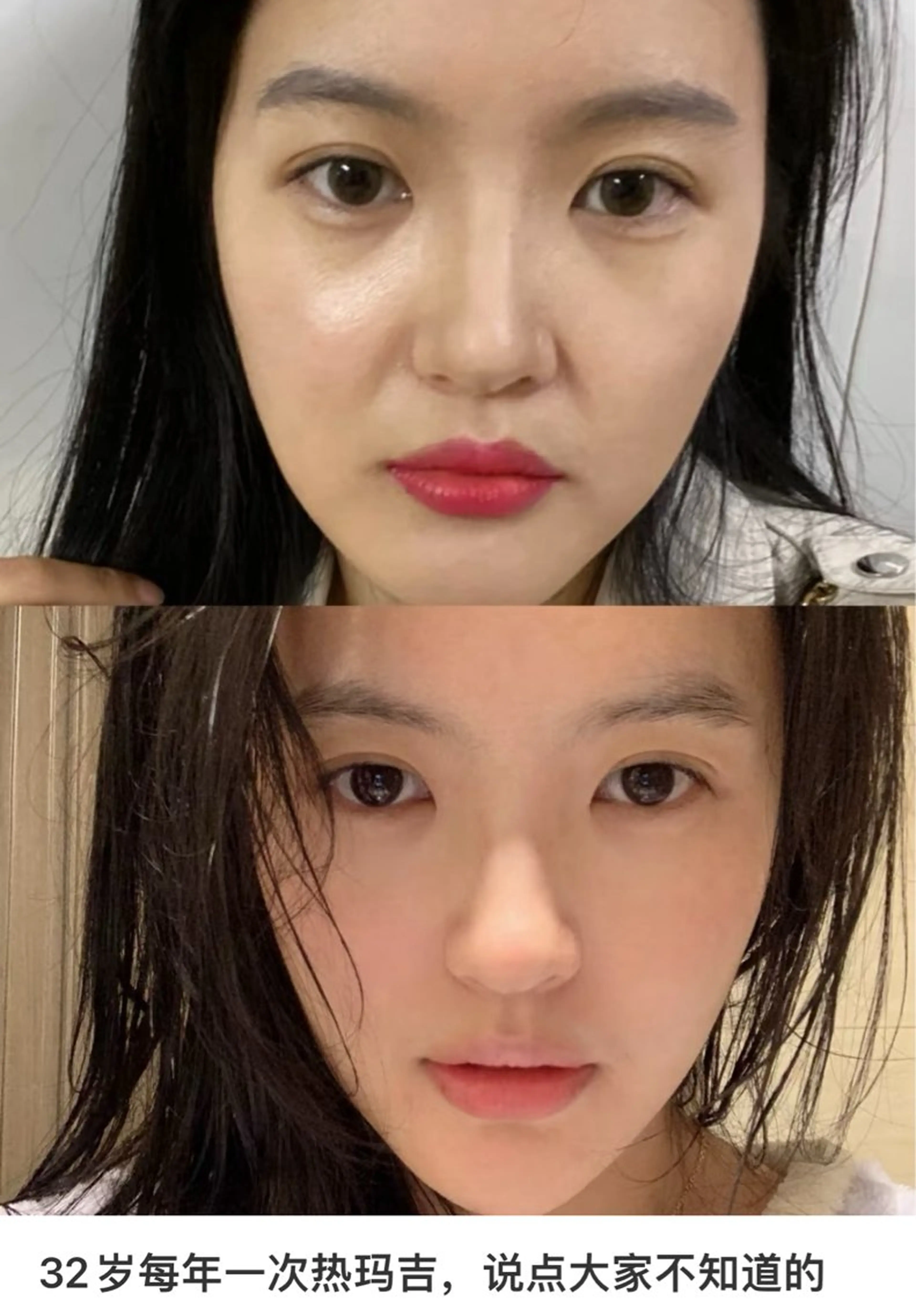 ショート エステ aliaハイフ&水光ジェットサロン所属・aliaハーブ水光店 エステティシャン募集のエステ・リラクイメージ