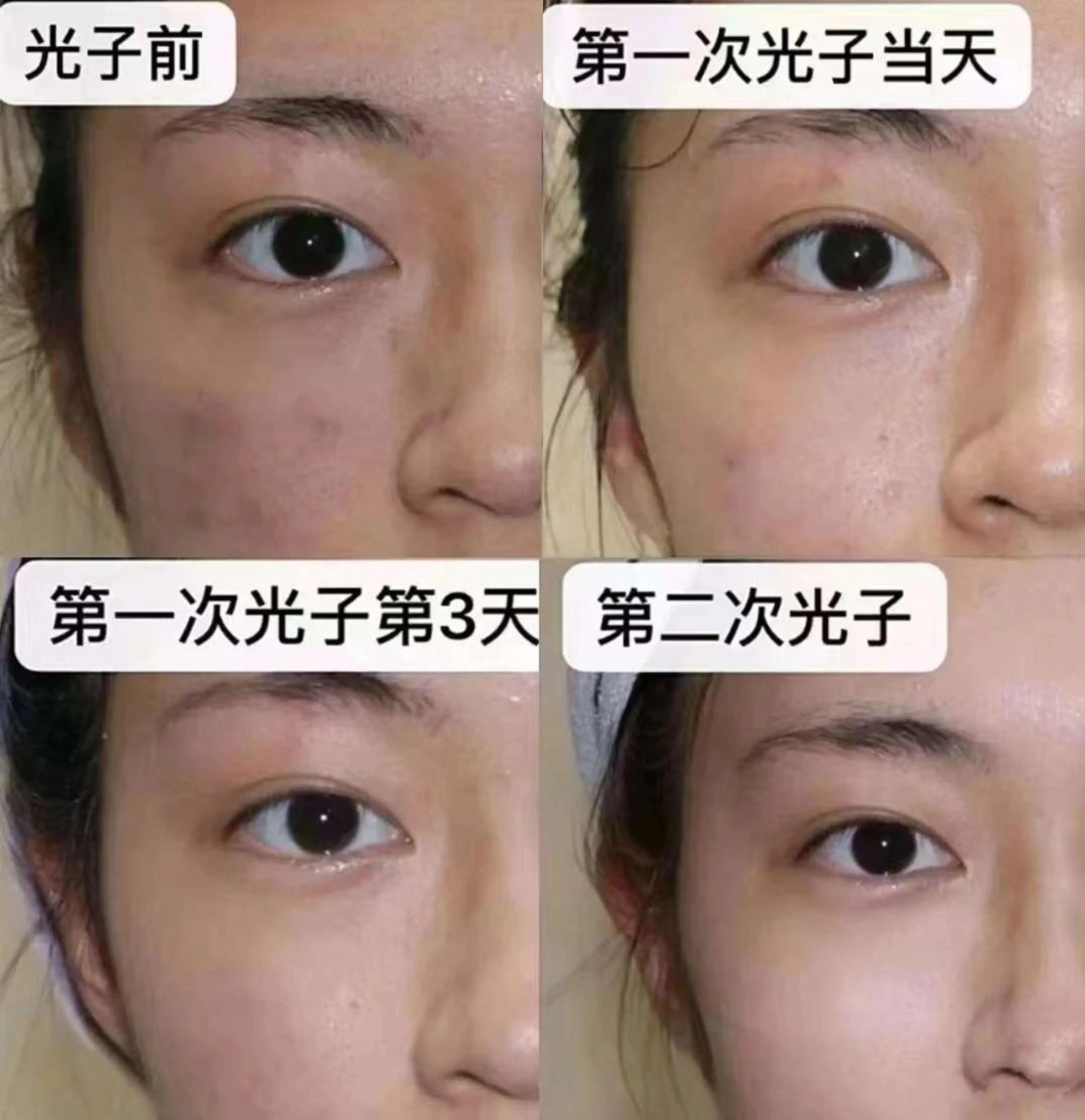 エステ aliaハイフ&水光ジェットサロン所属・aliaハーブ水光店 エステティシャン募集のエステ・リラクイメージ