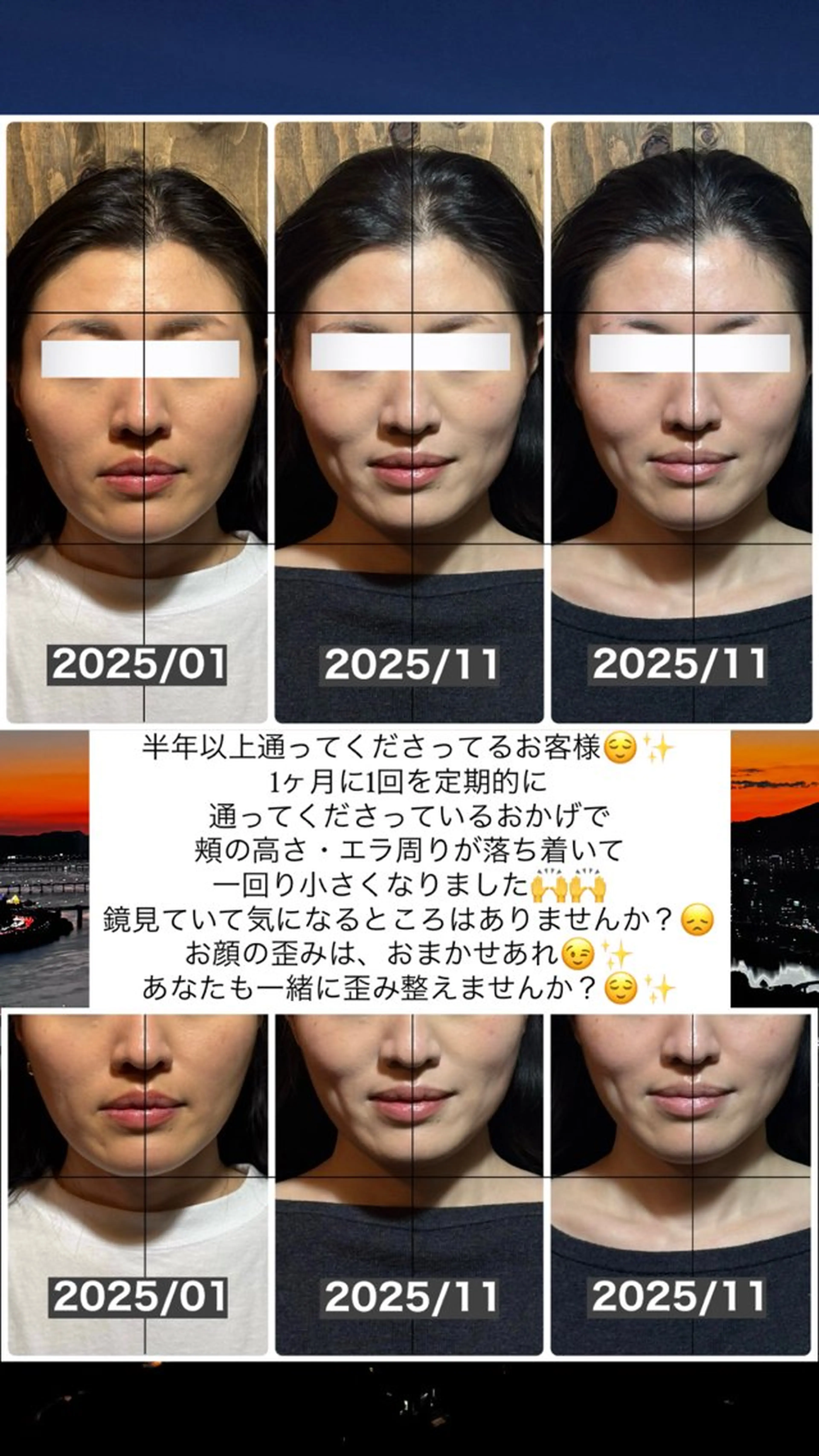 エステ リラク 💎後悔させない小顔 矯正💎イトヤマ🌱のエステ・リラクイメージ