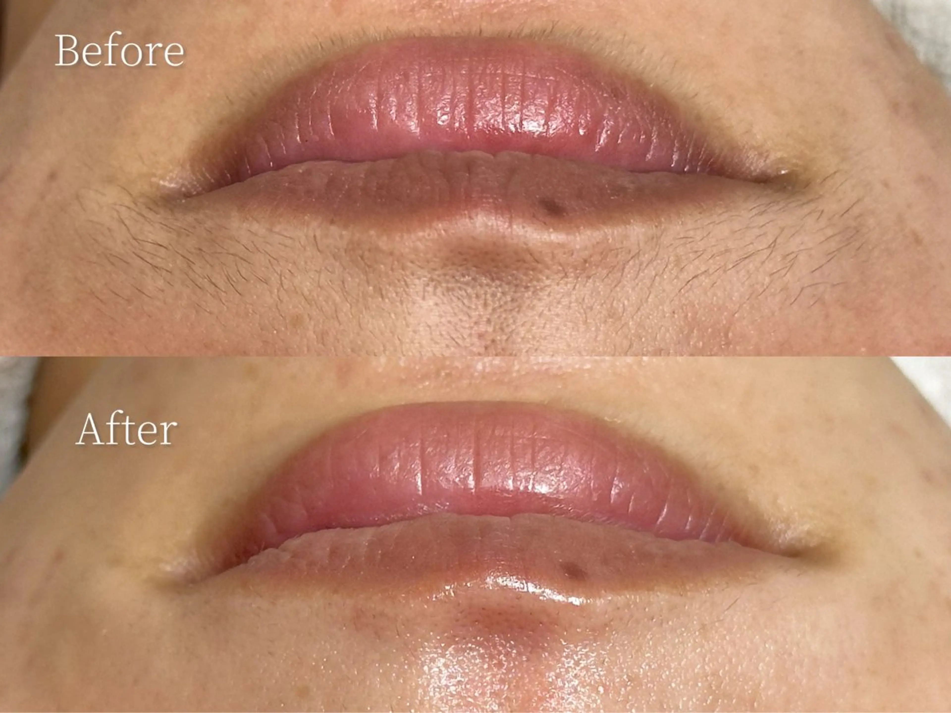 エステ MilleTendresses所属・本町オールハンド リラク/女性専用💐のエステ・リラクイメージ