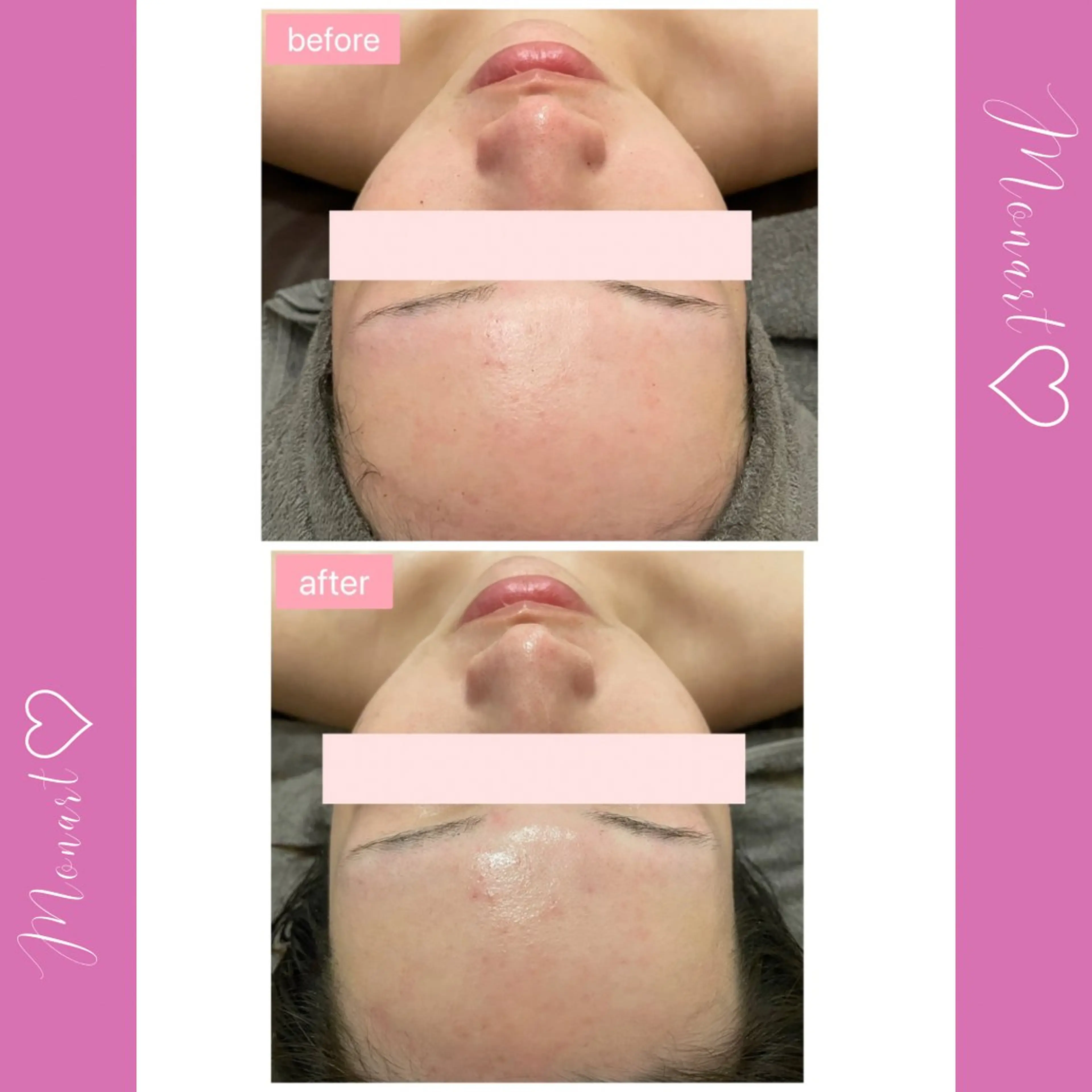 Monart -deux-のエステ・リラクイメージ