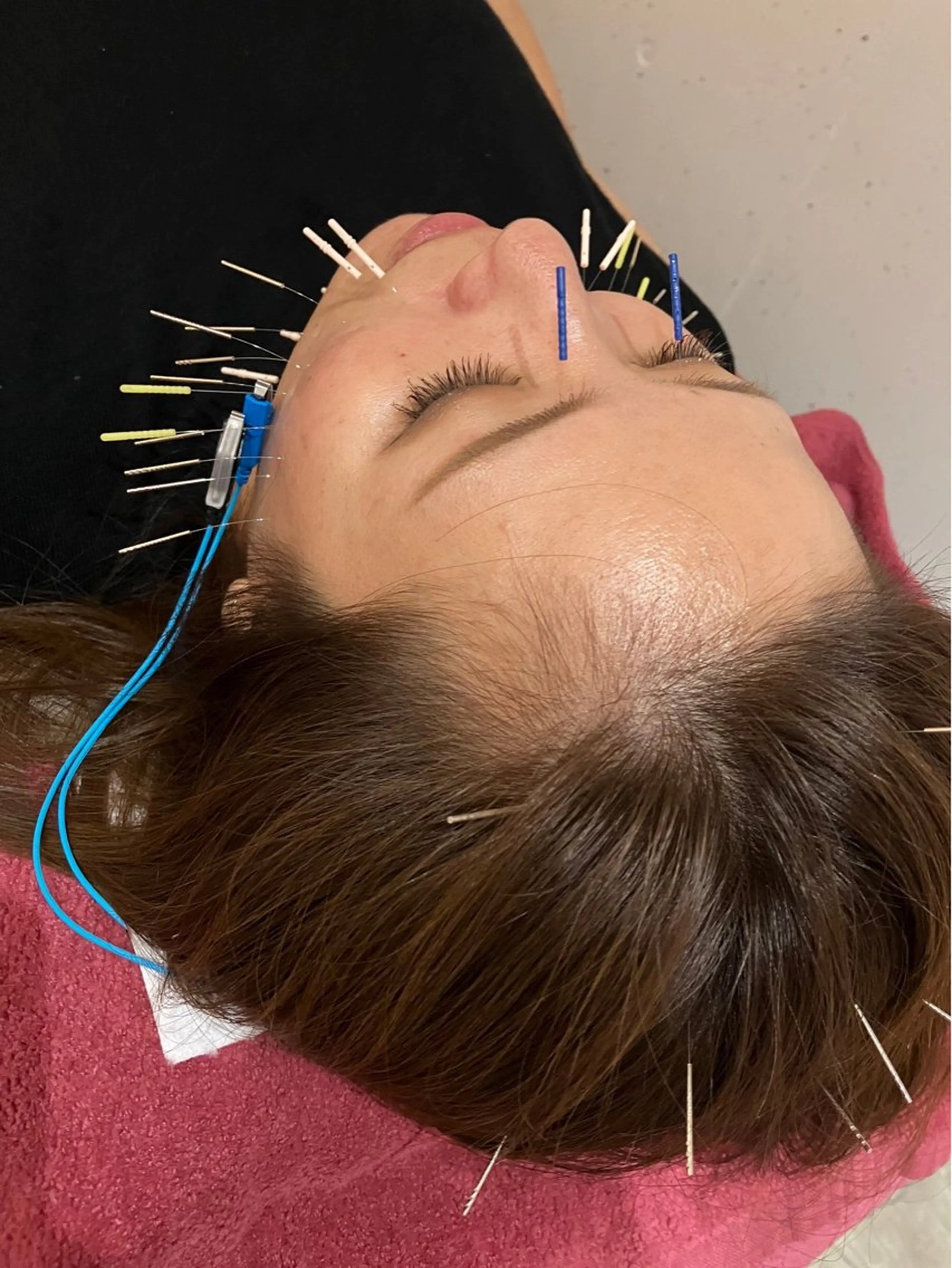 エステ リラク 美容鍼灸女性専用 りんご鍼灸治療院のその他イメージ