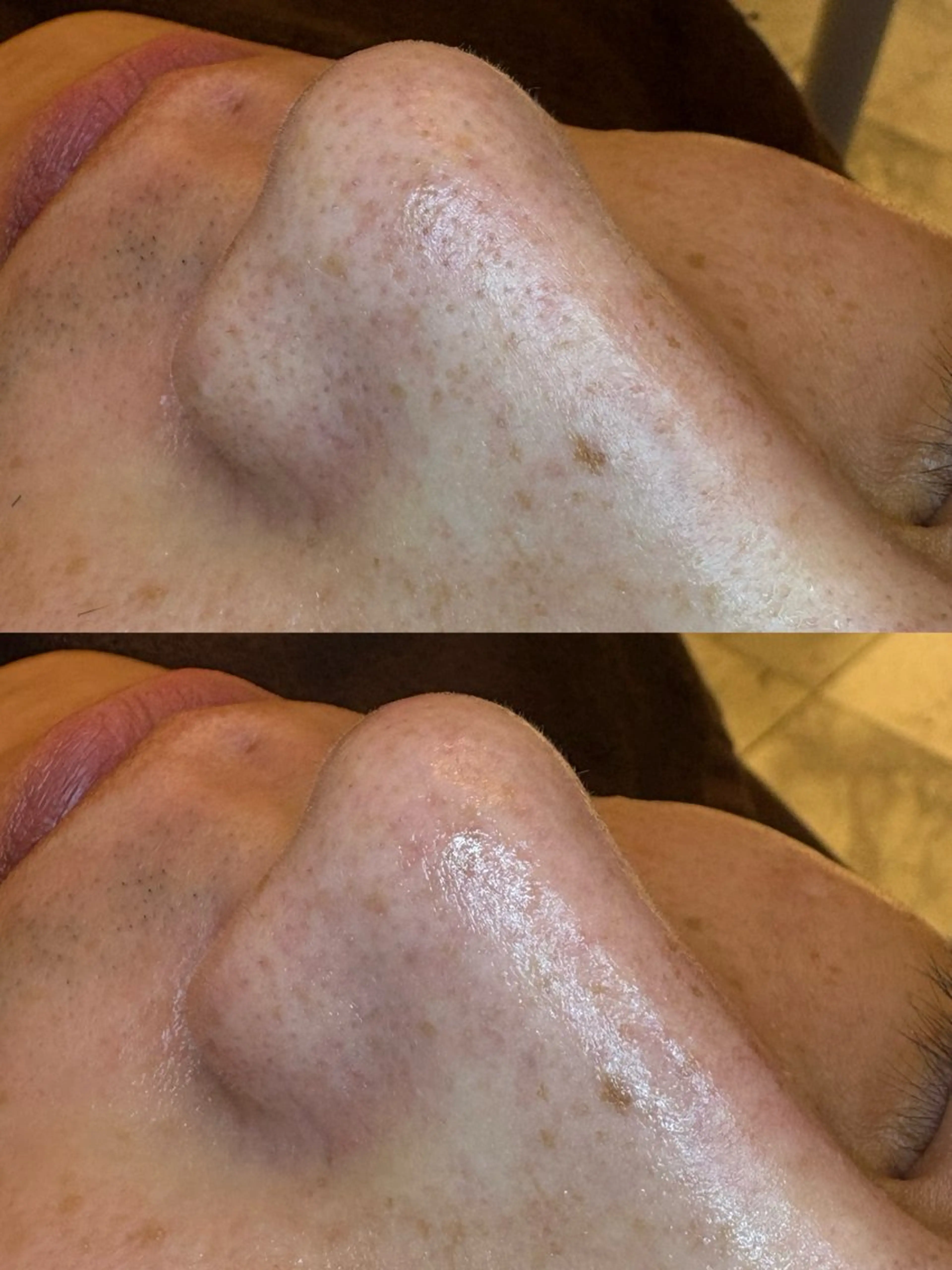 EARTH coiffure beaute 新潟紫竹山店所属・🤍アベシュリ /フェイシャル🤍のエステ・リラクイメージ