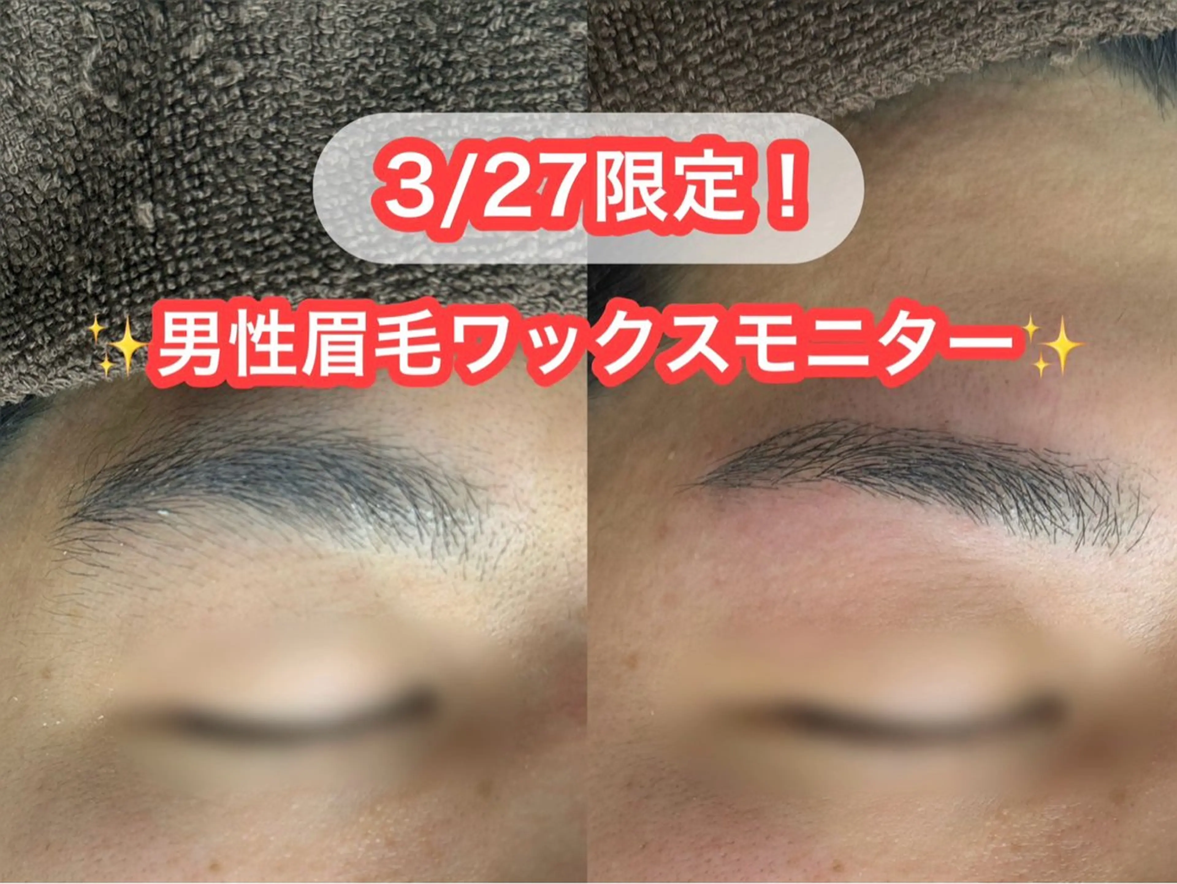 アイブロウ ワックス脱毛 その他(アイブロウ) ブラジリアンワックス No.A【池袋】のエステ・リラクイメージ