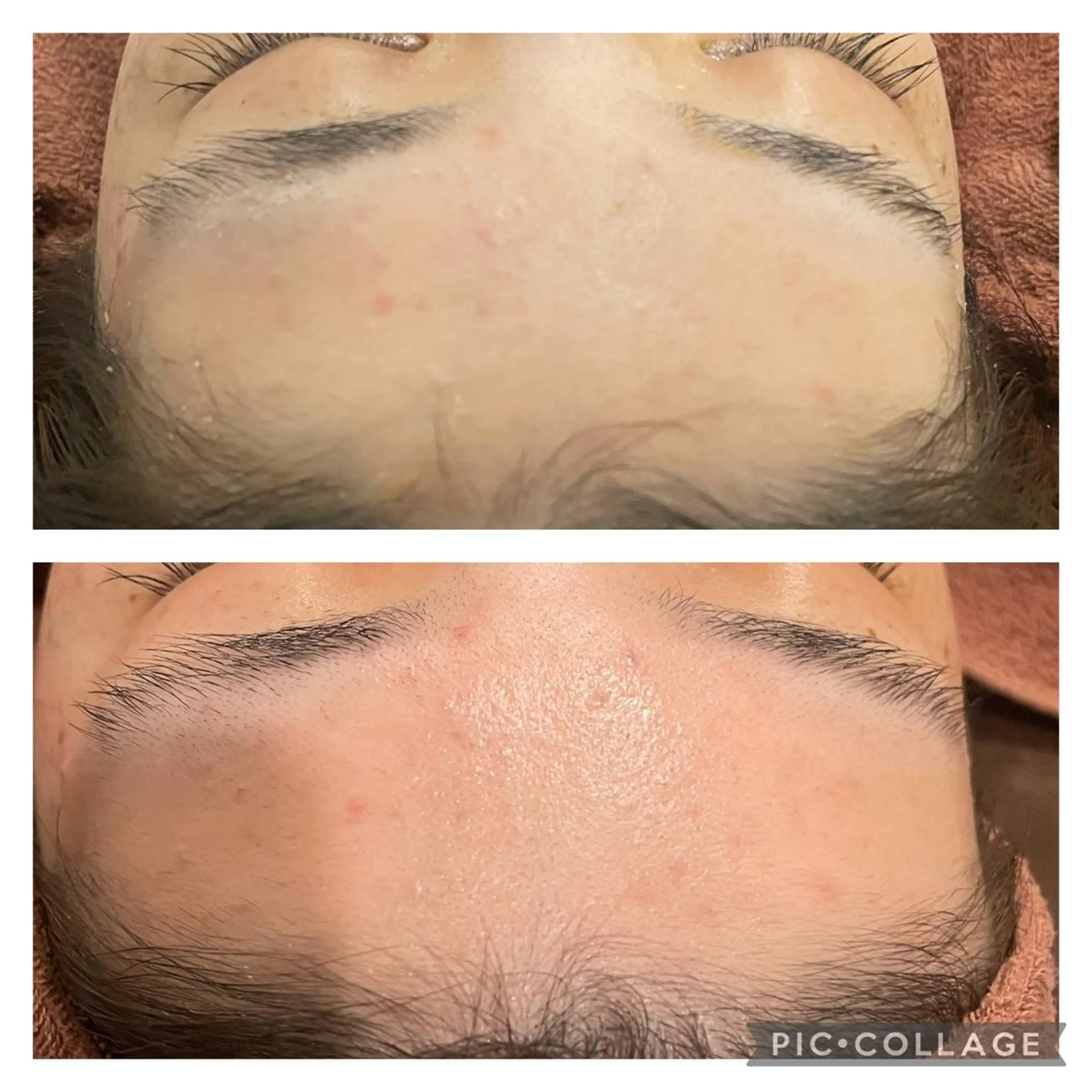 セミロング カラー パーマ ヘアアレンジ メンズ キッズ ネイル マツエク・マツパ アイブロウ ニキビ特化型エステ 🍓最短で肌質改善のその他イメージ