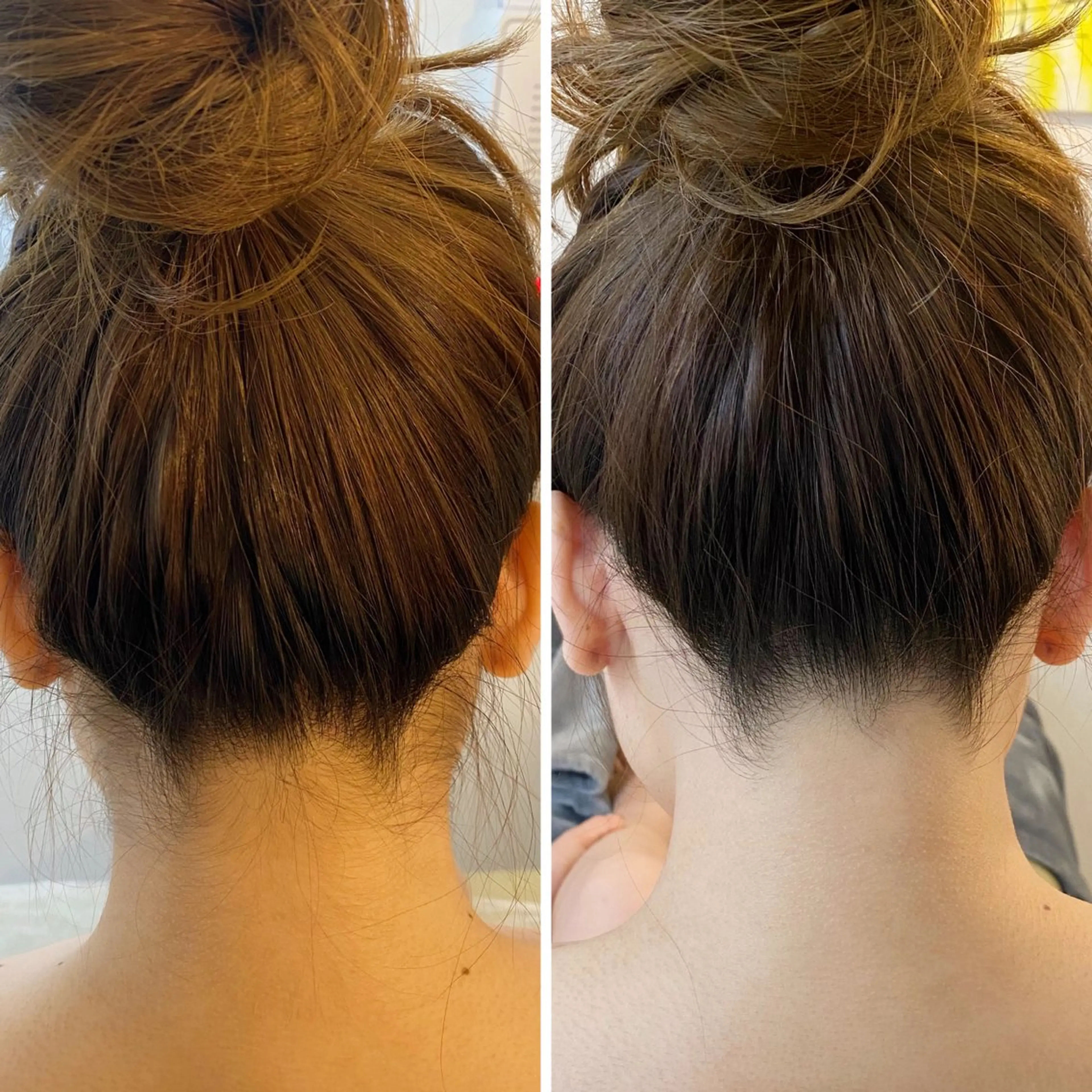 脱毛 うなじ脱毛/美肌脱毛 LABELのエステ・リラクイメージ