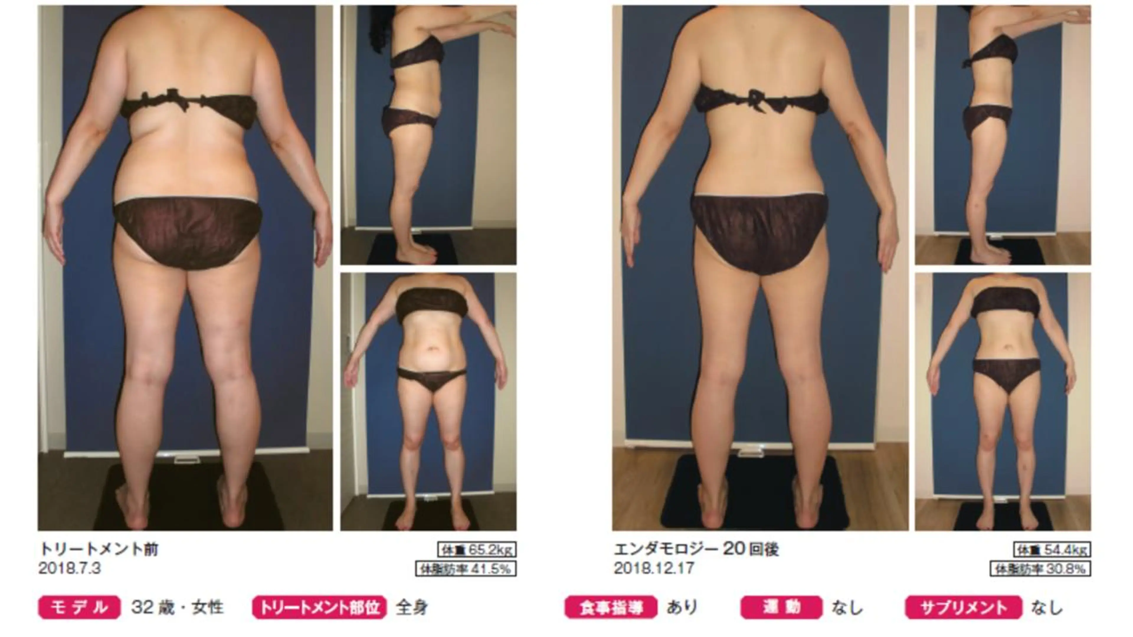 オレンジバナナ 県央店のエステ・リラクイメージ