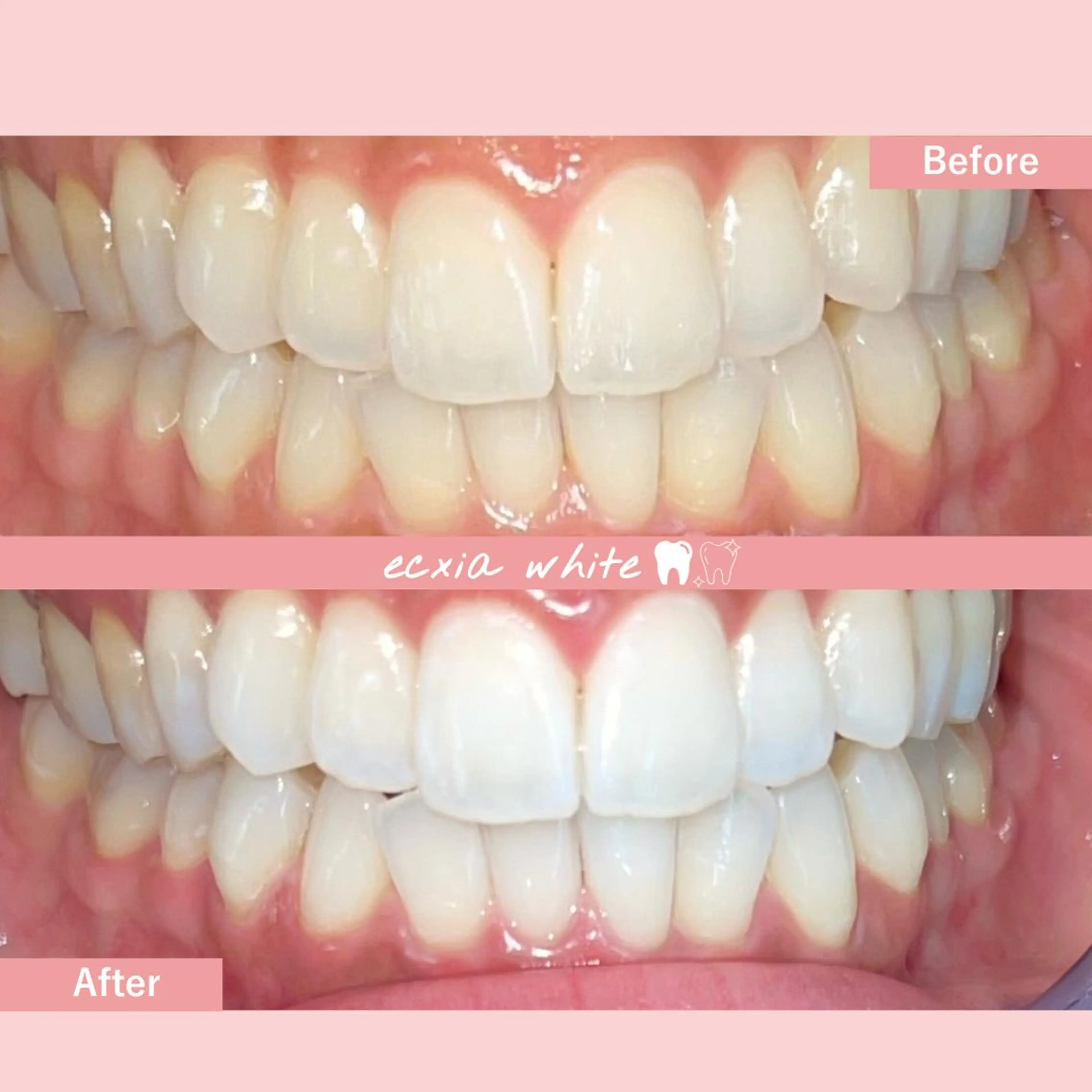 セルフホワイトニング エクシア中島公園店のその他イメージ