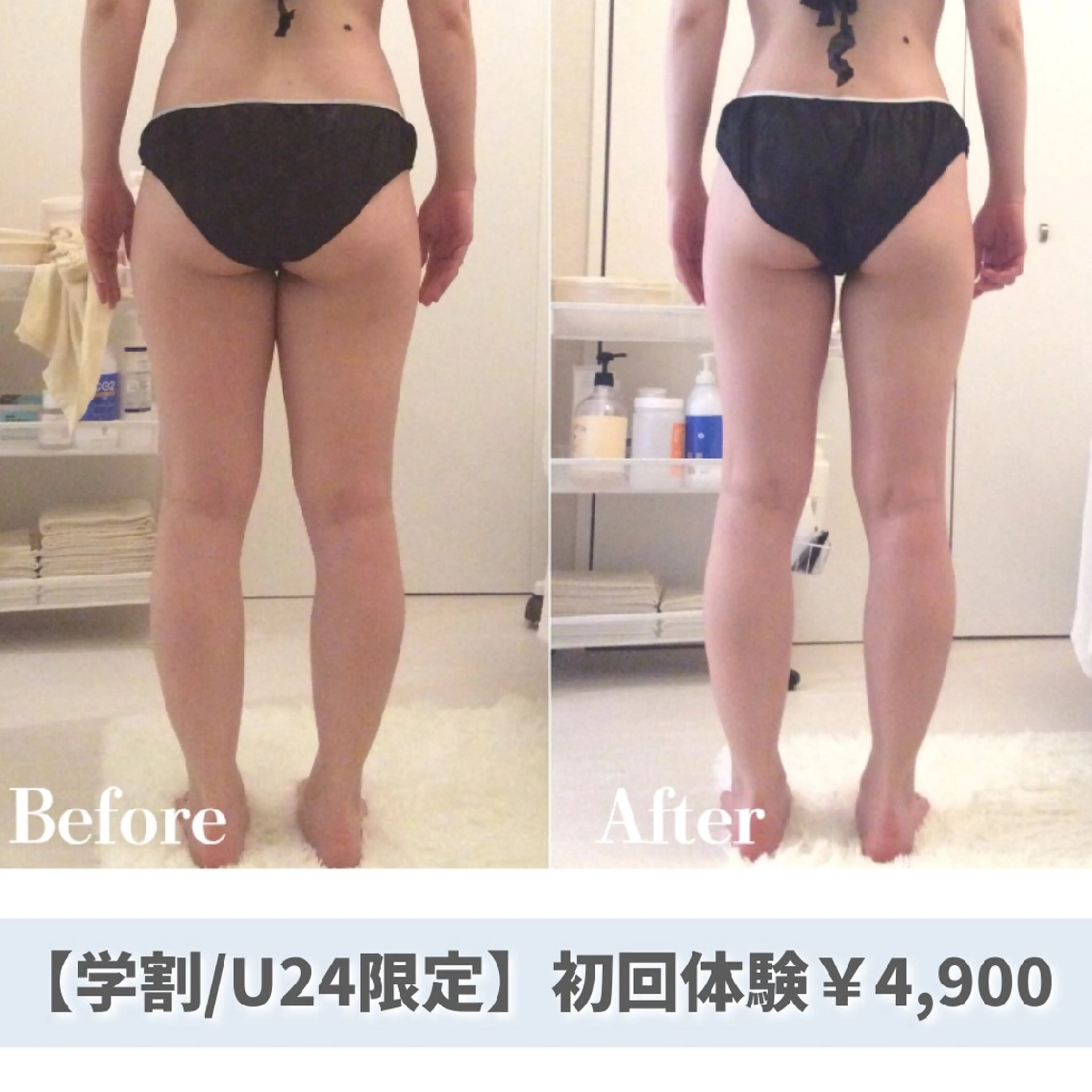 ​🉐【ミニモ学割/U24】トリプル溶解痩身45分✨美脚・くびれ・二の腕・ハミ肉など気になるところを集中ケア✨の写真