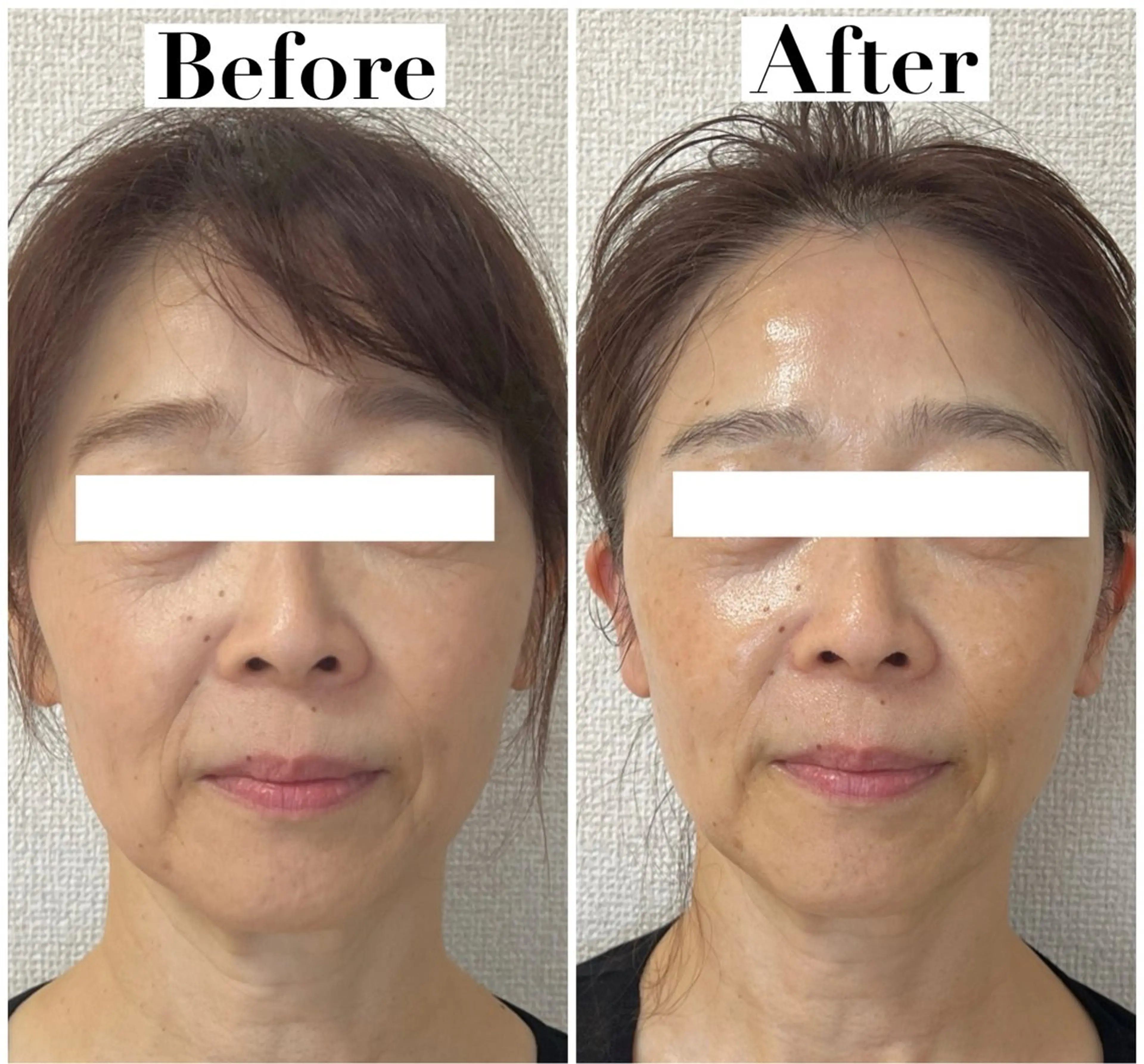 エステ リラク たるみ改善サロン Ｍdesignのエステ・リラクイメージ