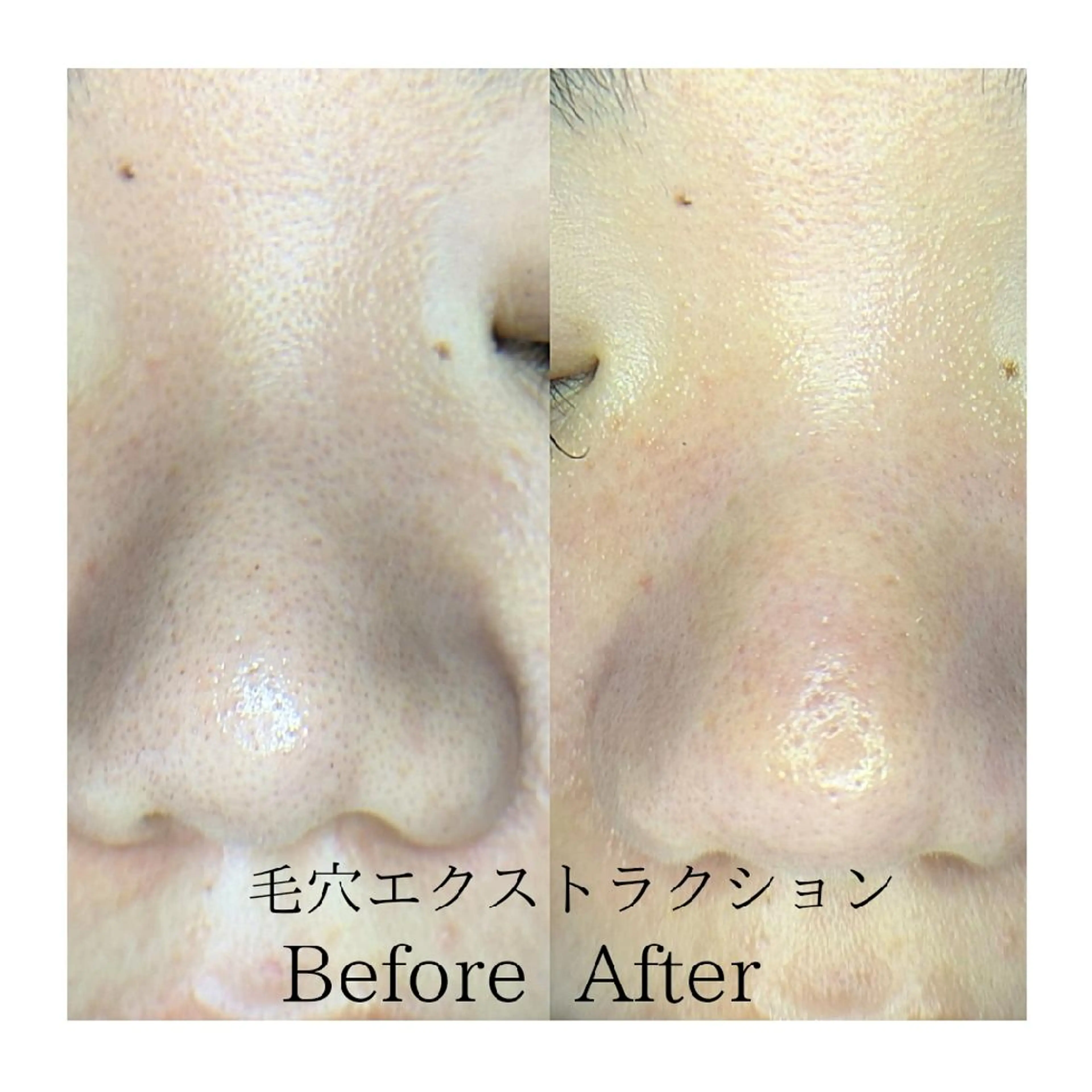 エステ リラク  毛穴洗浄・まつ毛 の専門店 ソラーレのエステ・リラクイメージ