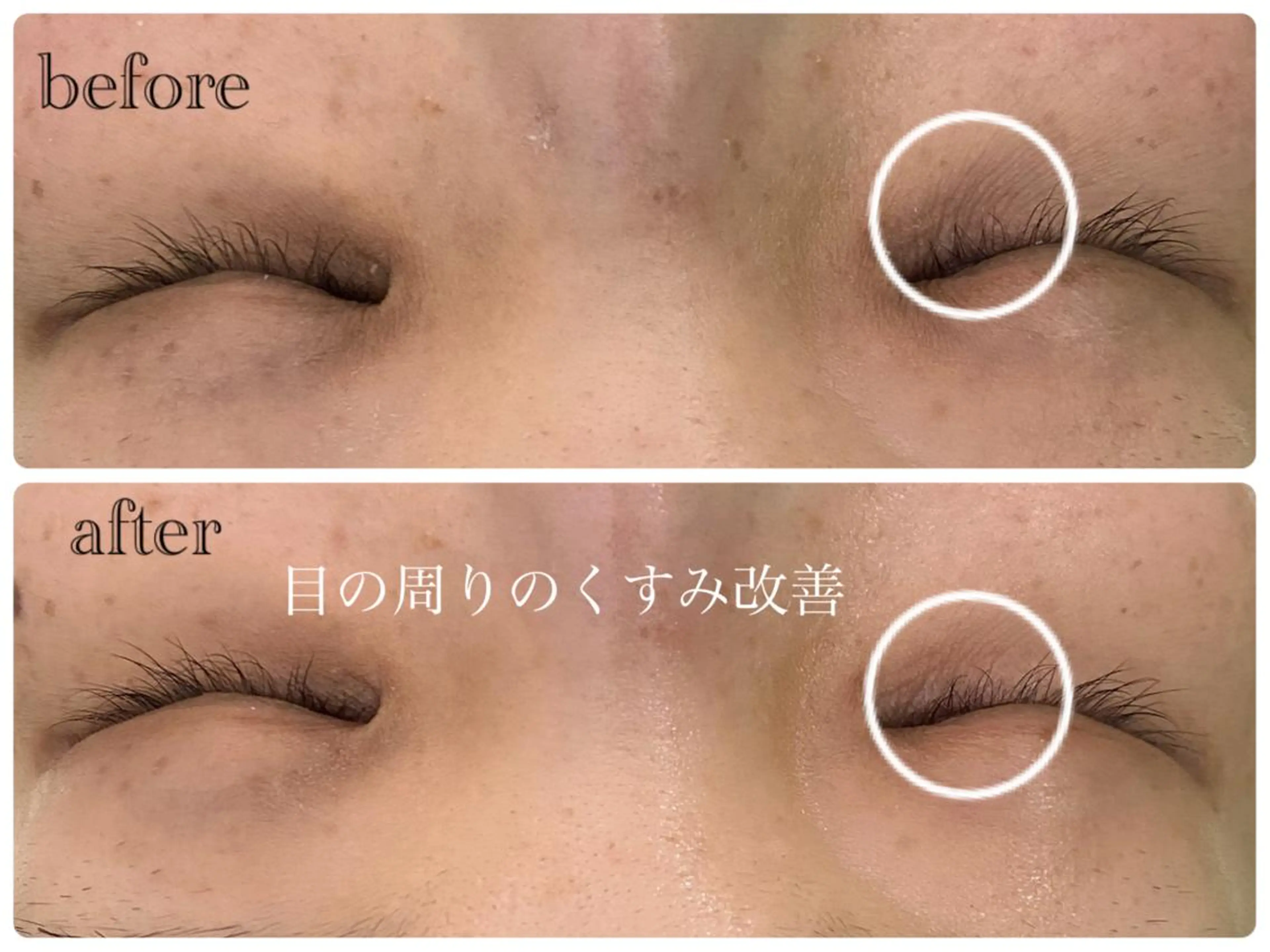 デ・アイム新潟北所属・サイトウ .のエステ・リラクイメージ