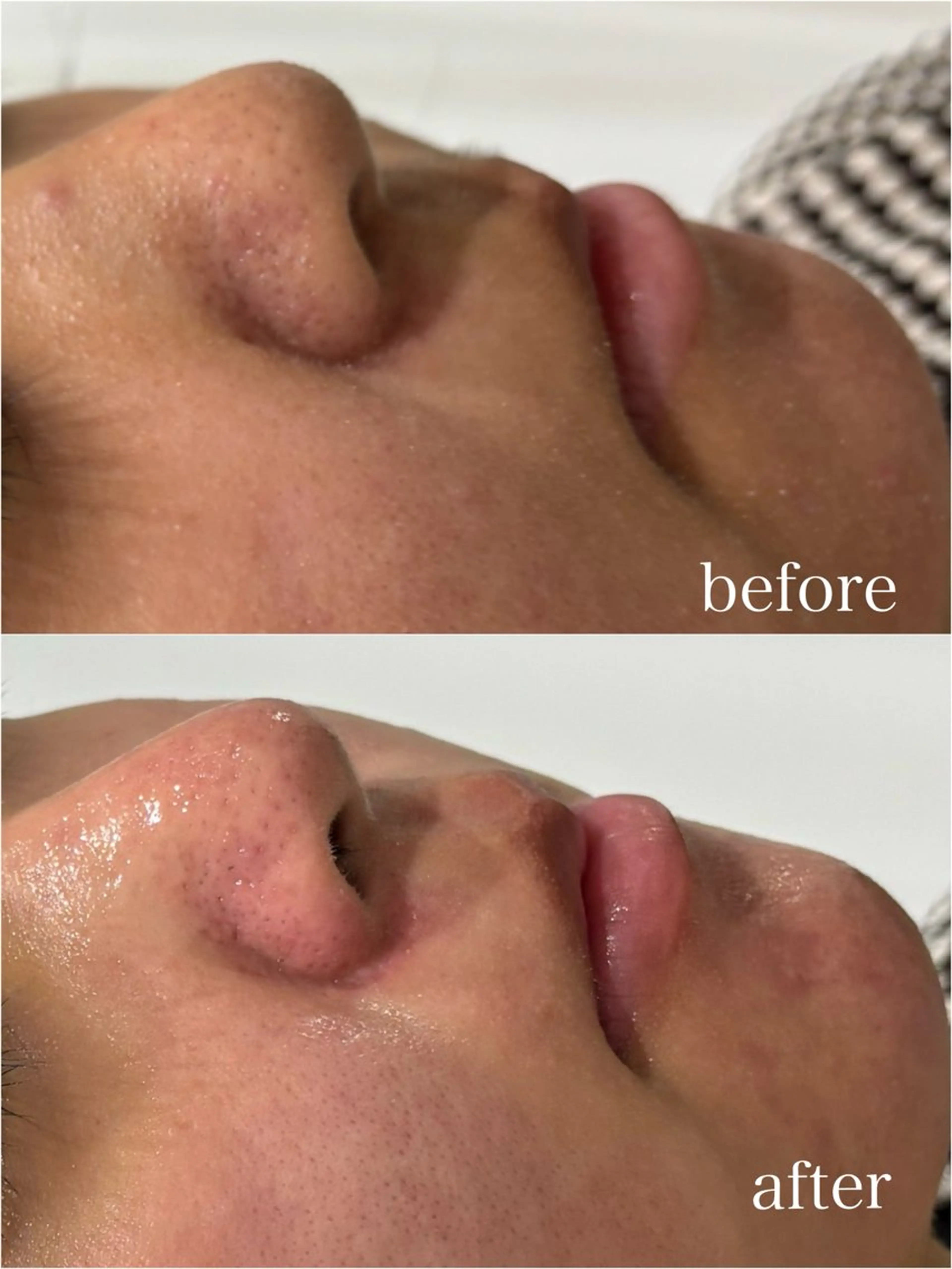 エステ MY FAIR LADY所属・毛穴に特化したサロン MYFAIRLADYのエステ・リラクイメージ