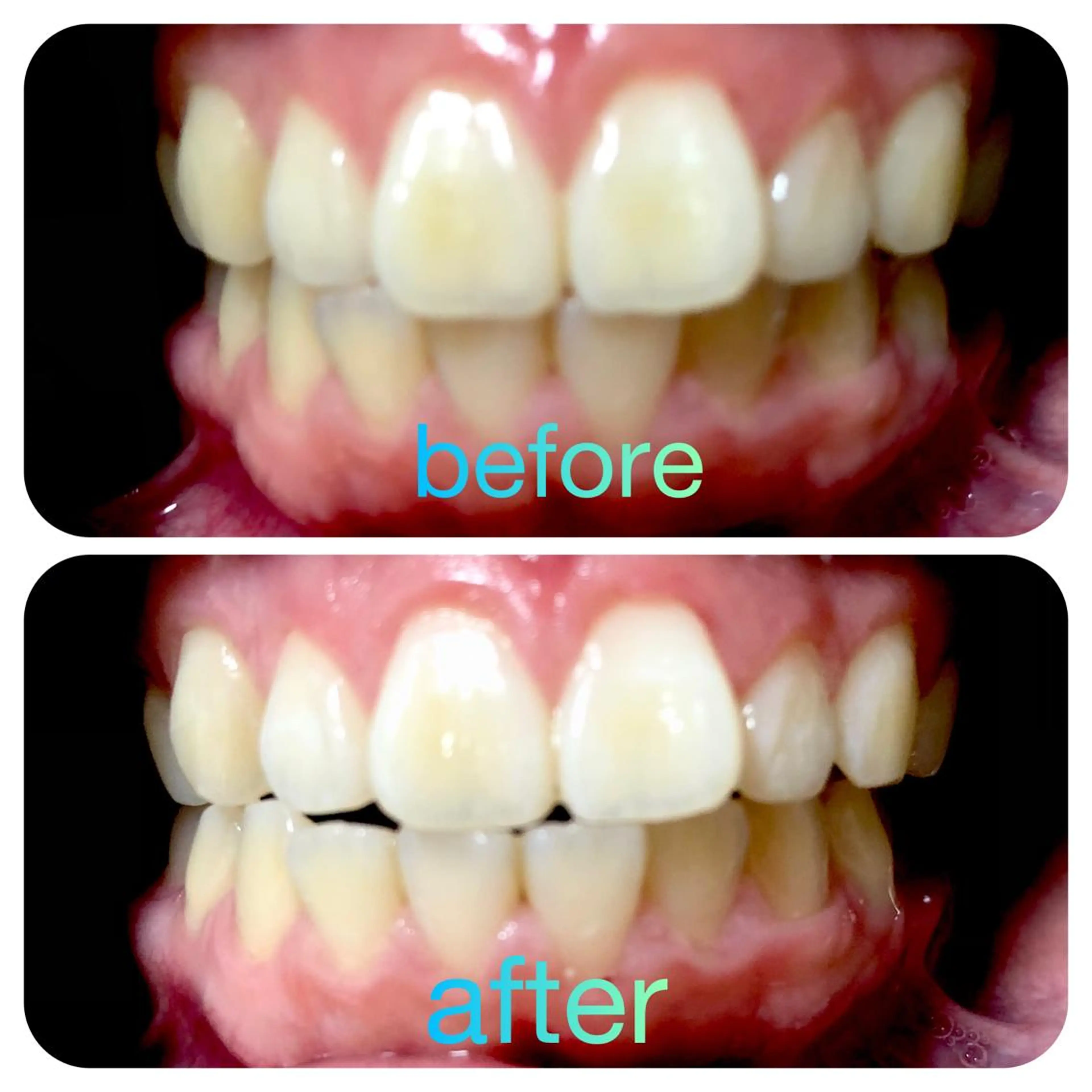 その他 two nailのネイルデザイン