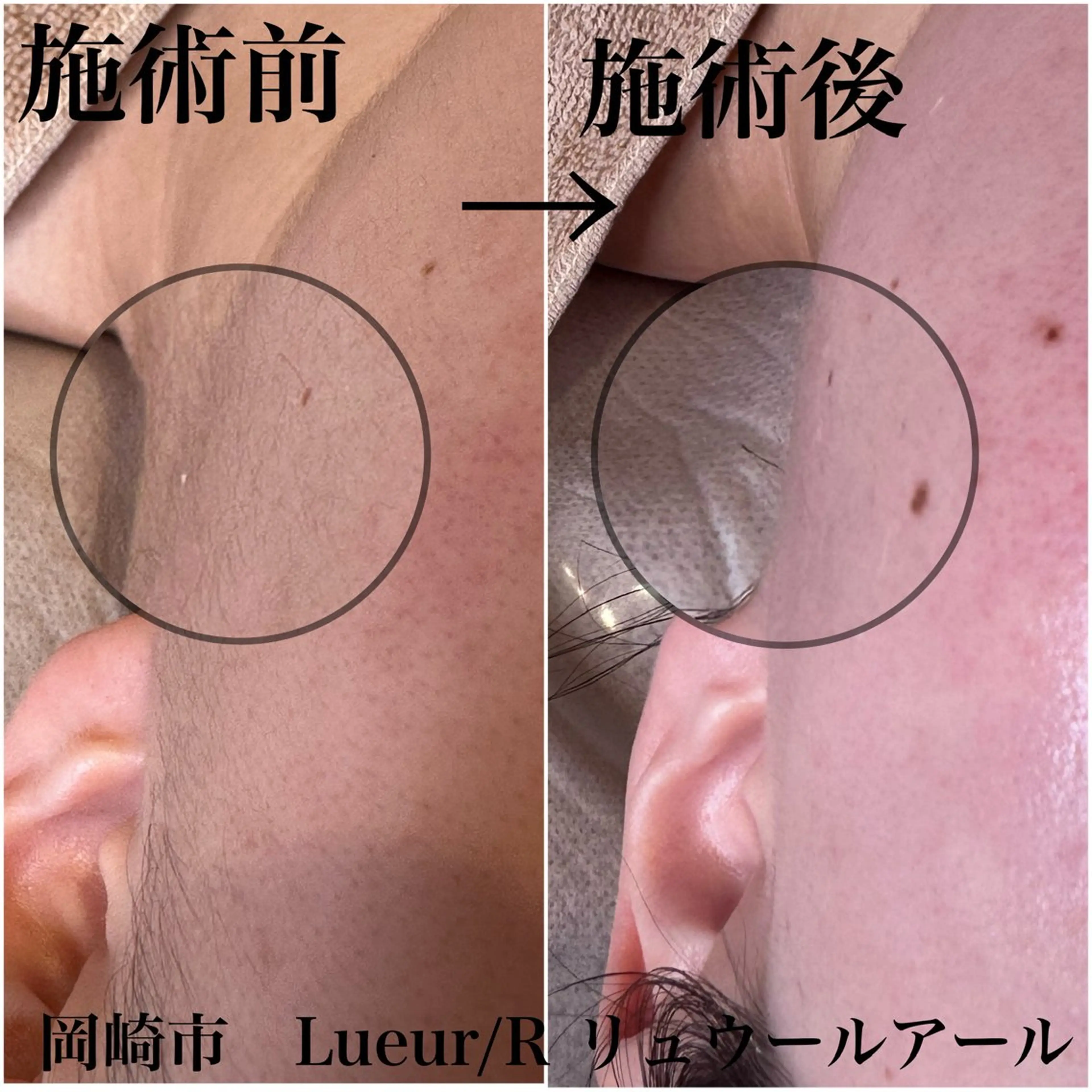 その他 大久保 里奈のエステ・リラクイメージ