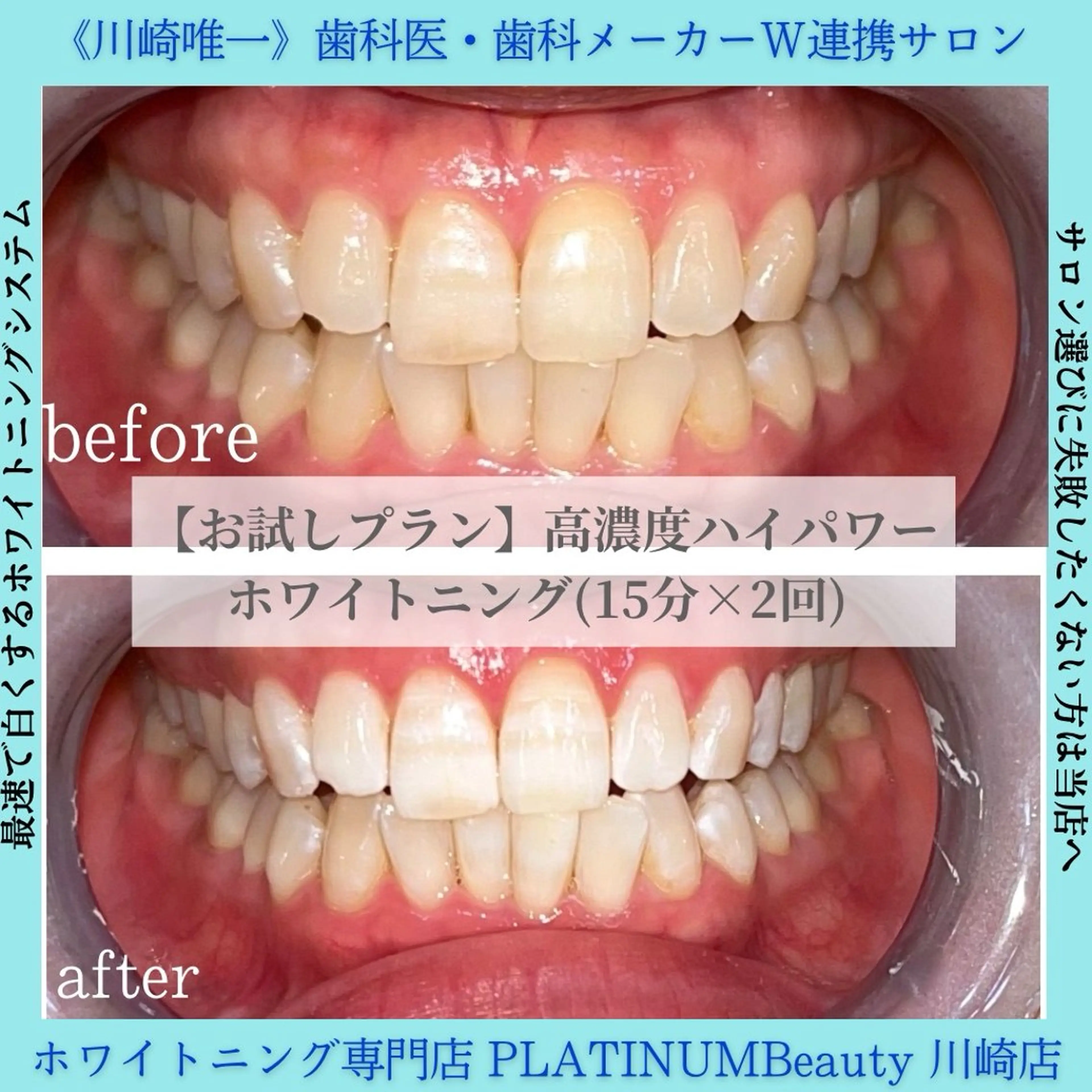 ホワイトニング専門店 PLATINUM Beauty 川崎店所属・PLATINUM Beauty 川崎店のその他イメージ