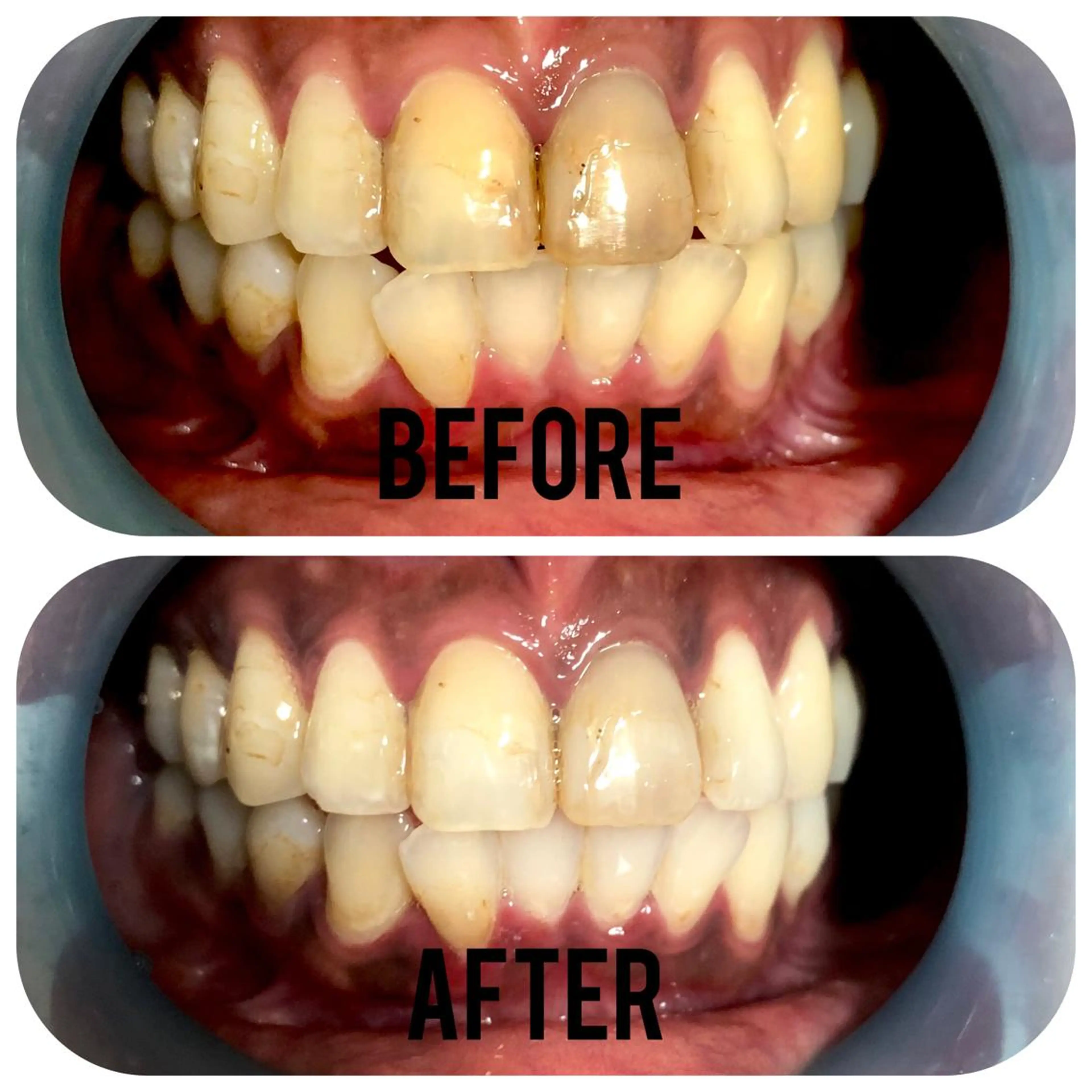 その他 two nailのネイルデザイン