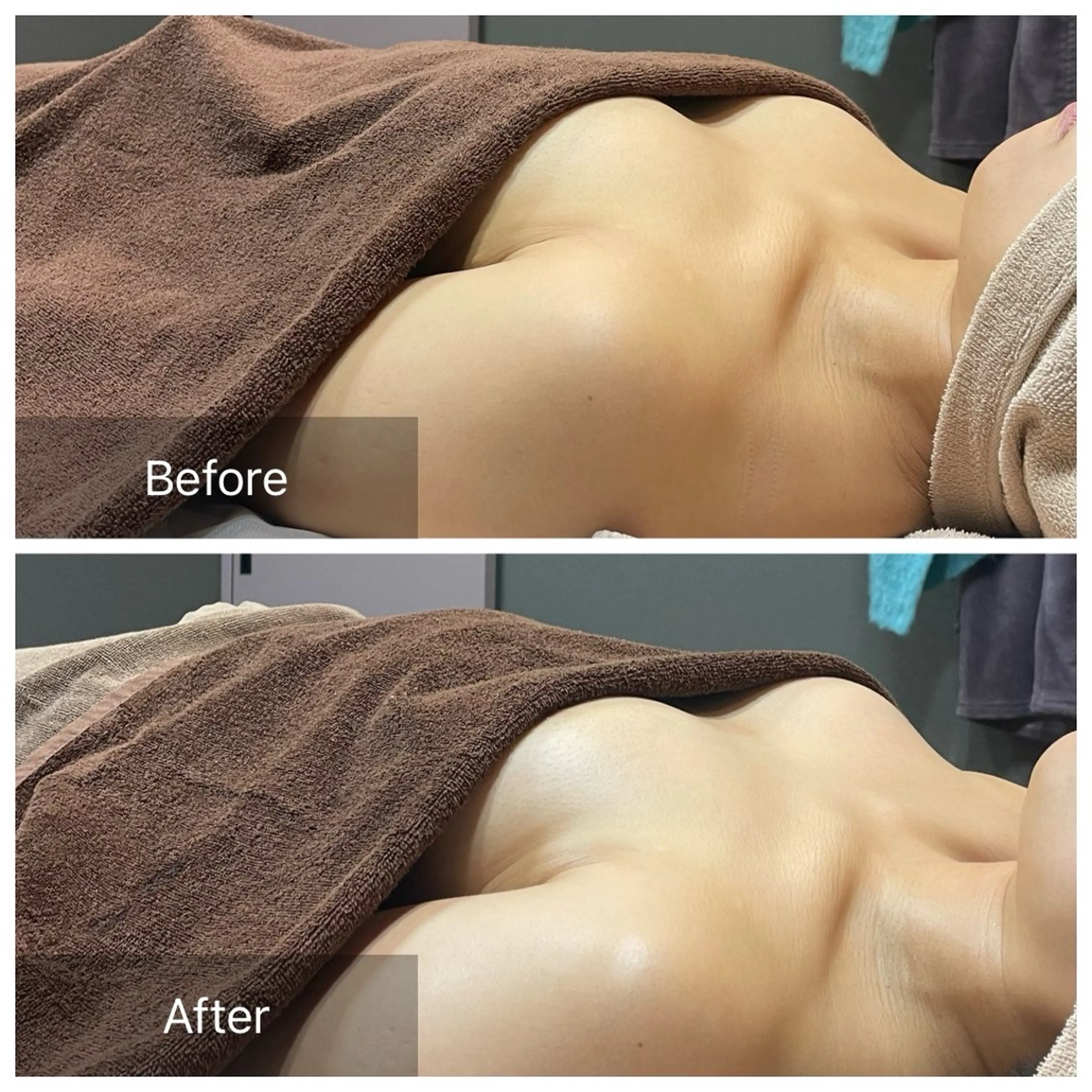 バストマッサージ（カウンセリング含めて90分です）の写真