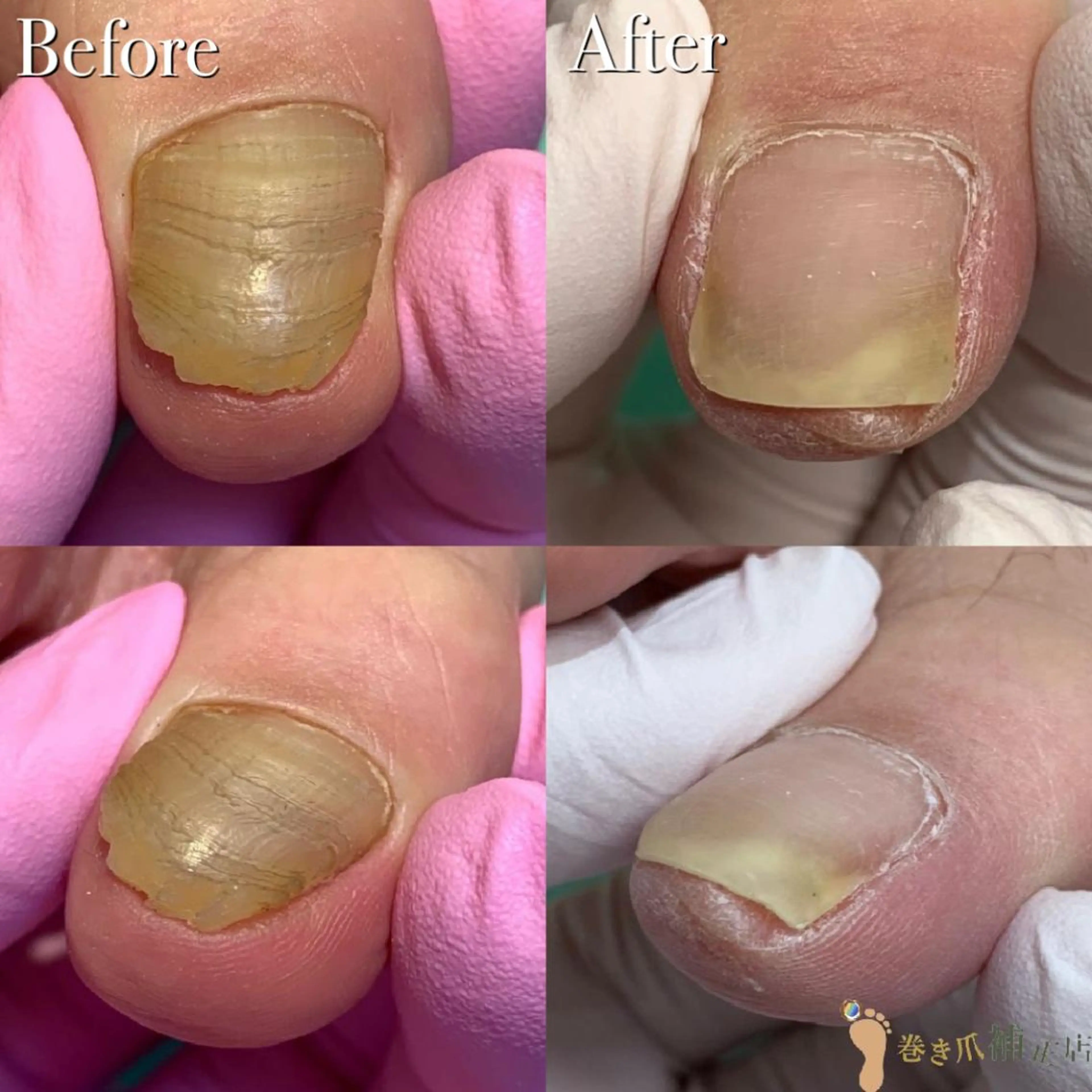 ネイル 東京巻き爪アカデミー所属・東京巻き爪 アカデミーのエステ・リラクイメージ