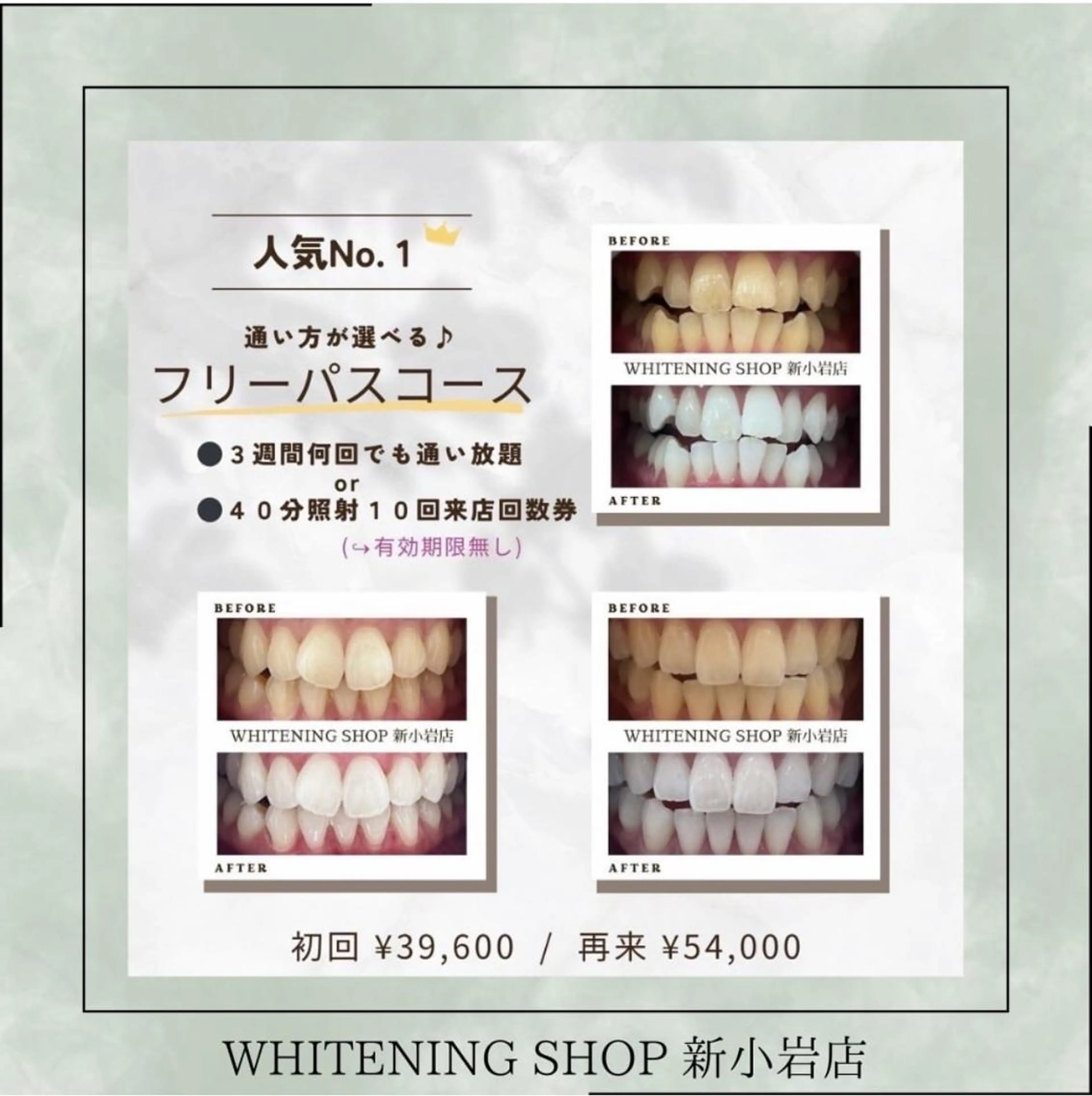 メンズ その他 ホワイトニング ショップ新小岩店のその他イメージ